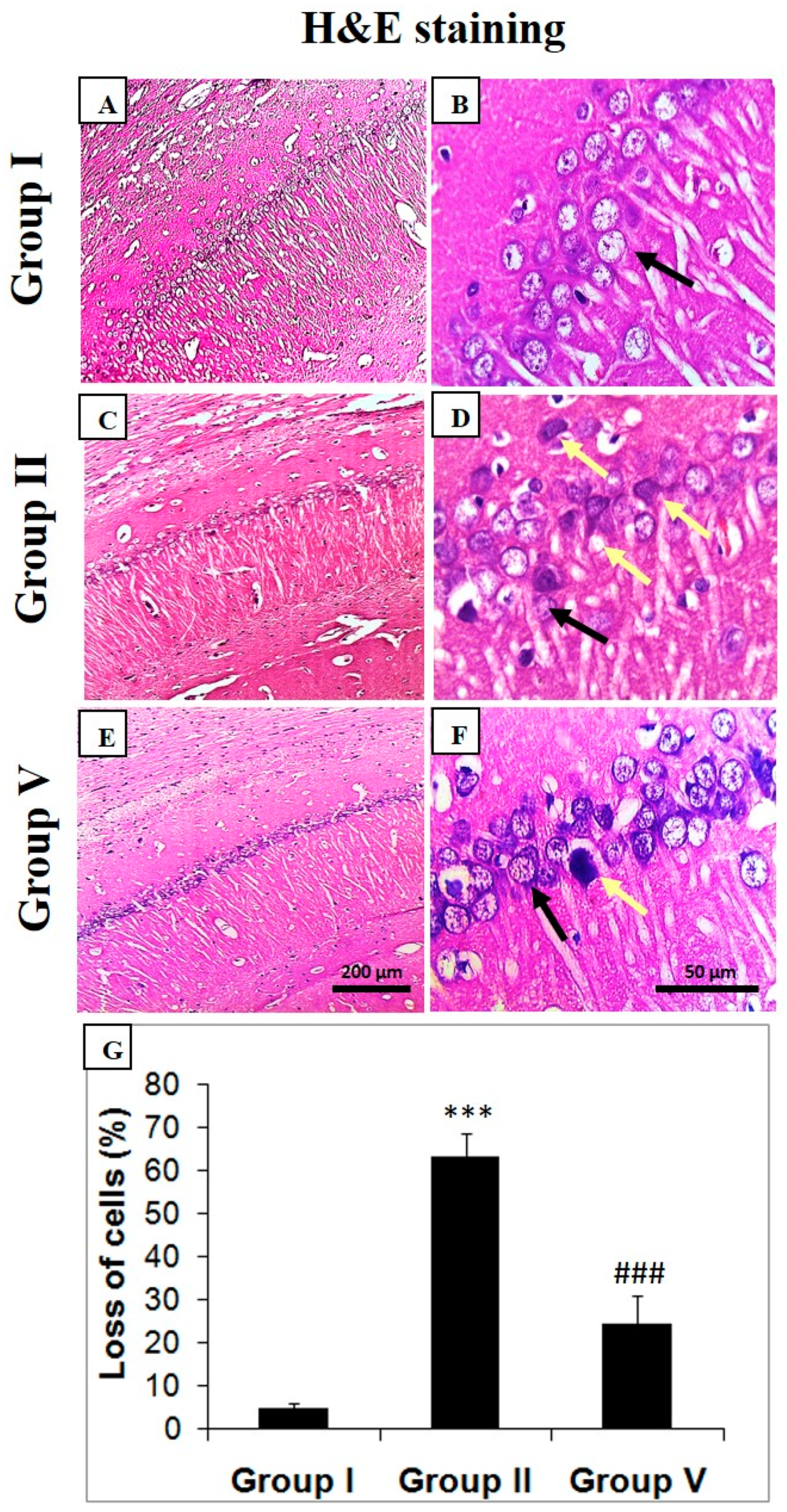 Pharmaceuticals 14 00146 g003 Pharmaceuticals 14 00146 g003
