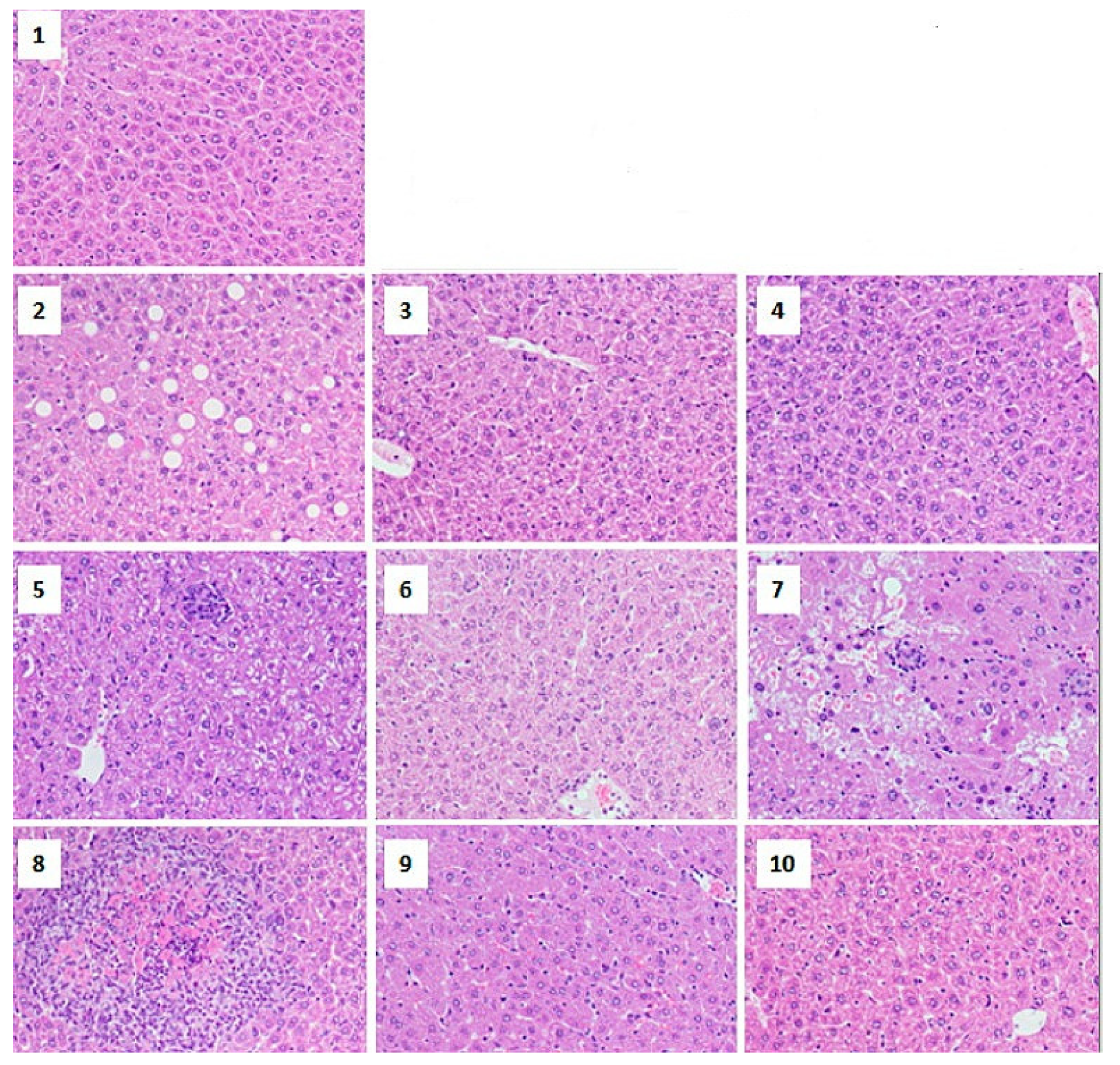 Pharmaceuticals 14 00215 g004