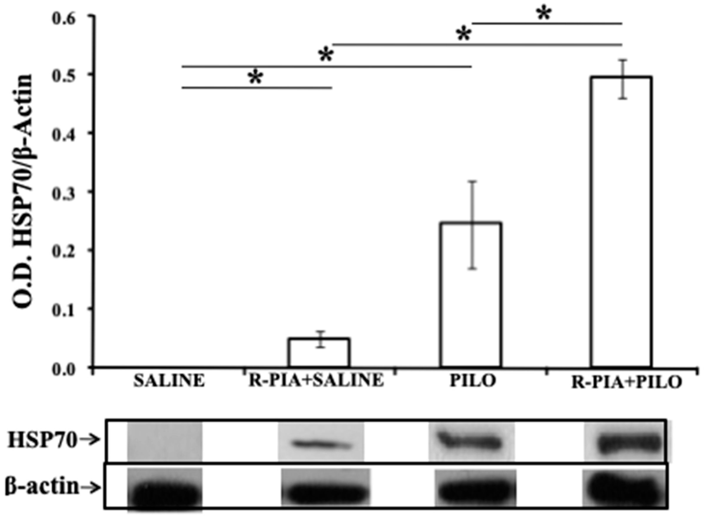 Pharmaceuticals 14 00376 g004