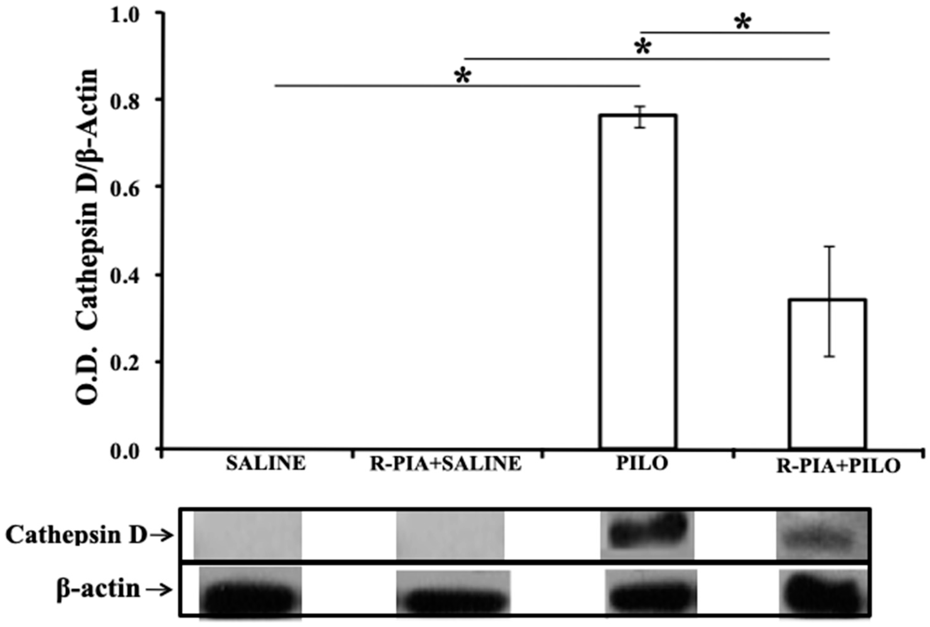 Pharmaceuticals 14 00376 g005