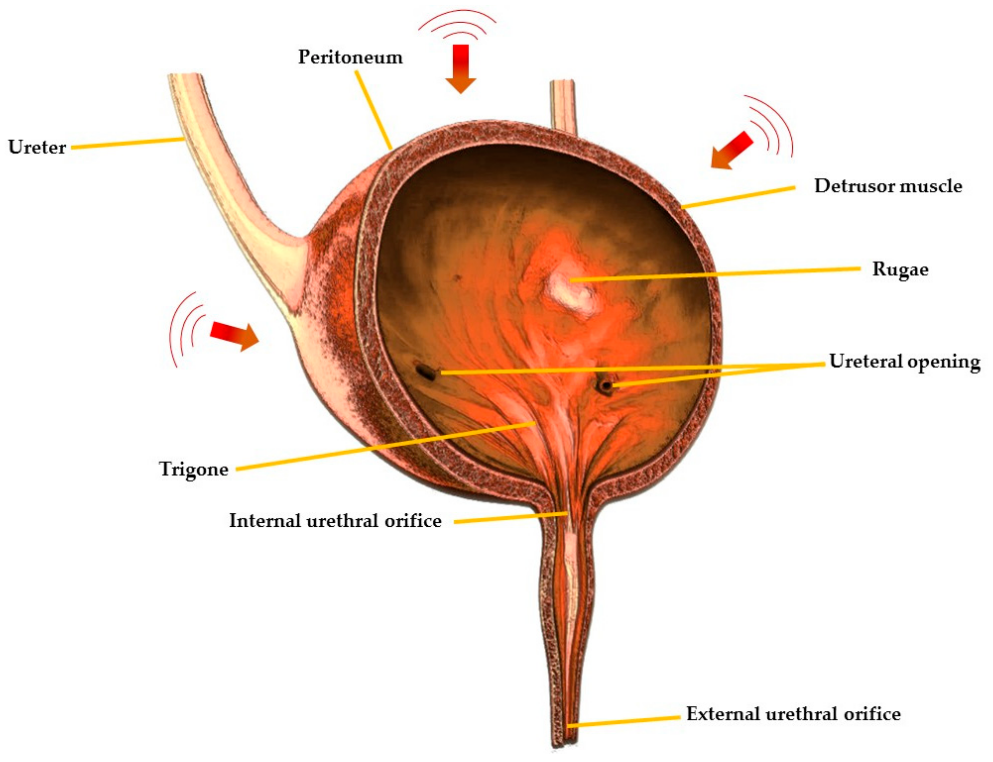 Overactive Bladder Causes, Treatment and Remedies - Dr. Axe