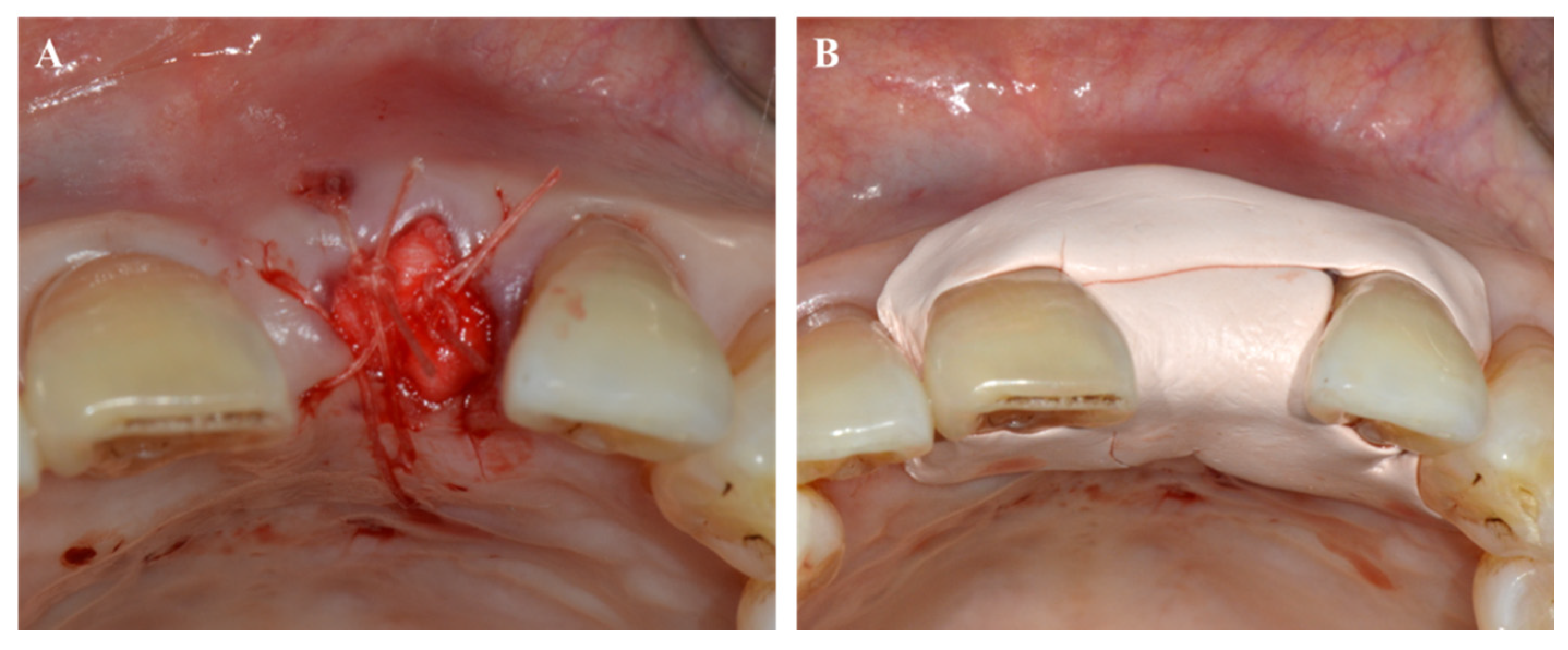 Pharmaceuticals 14 00456 g005 Pharmaceuticals 14 00456 g005