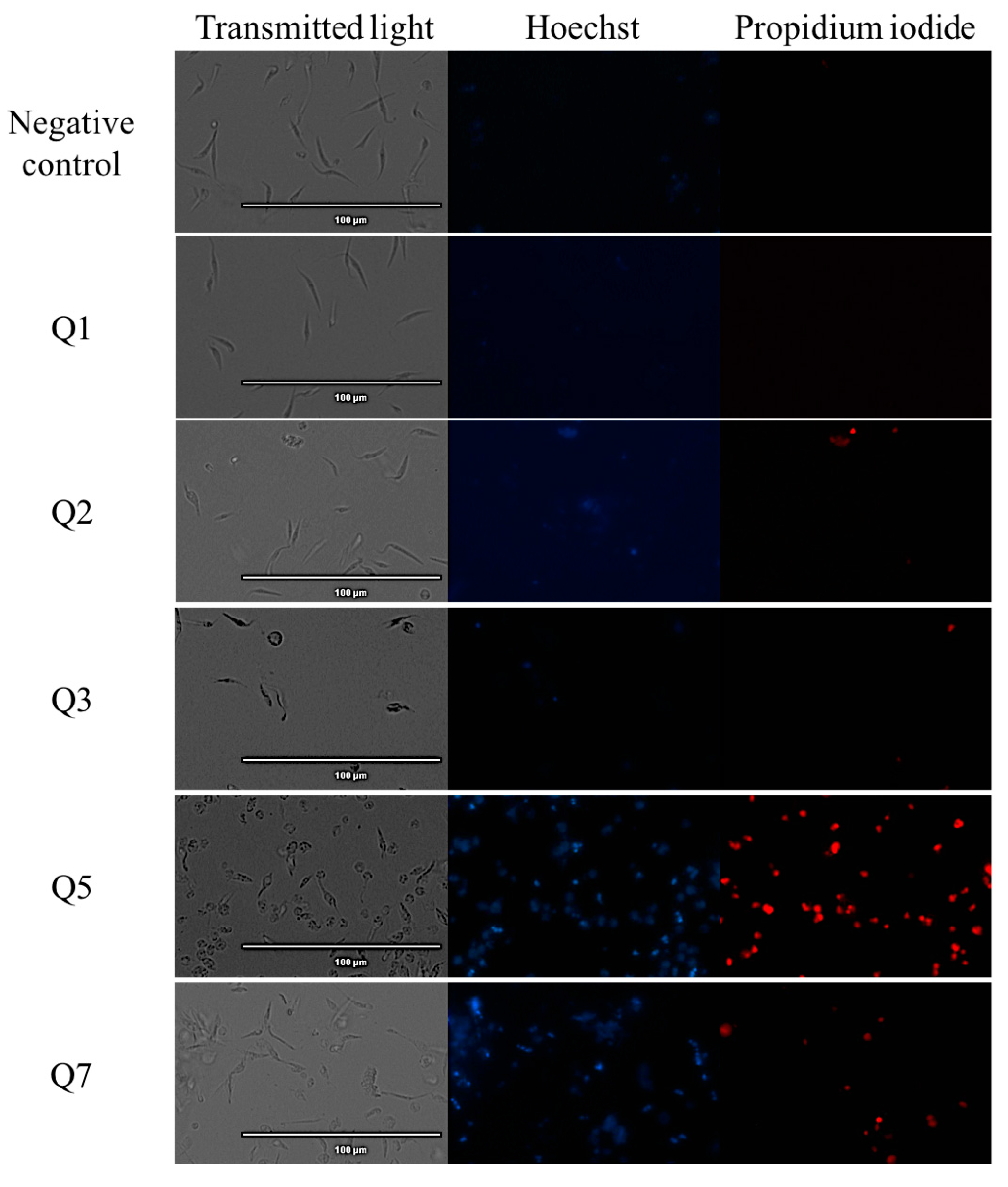 Acrylonitrile Derivatives against Trypanosoma cruzi: In Vitro 