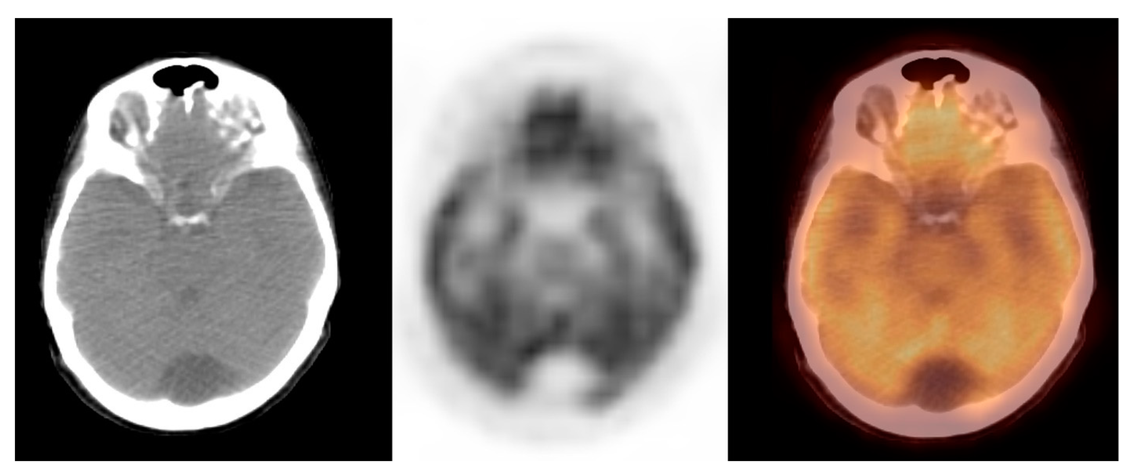 Pharmaceuticals 14 00722 g003 Pharmaceuticals 14 00722 g003