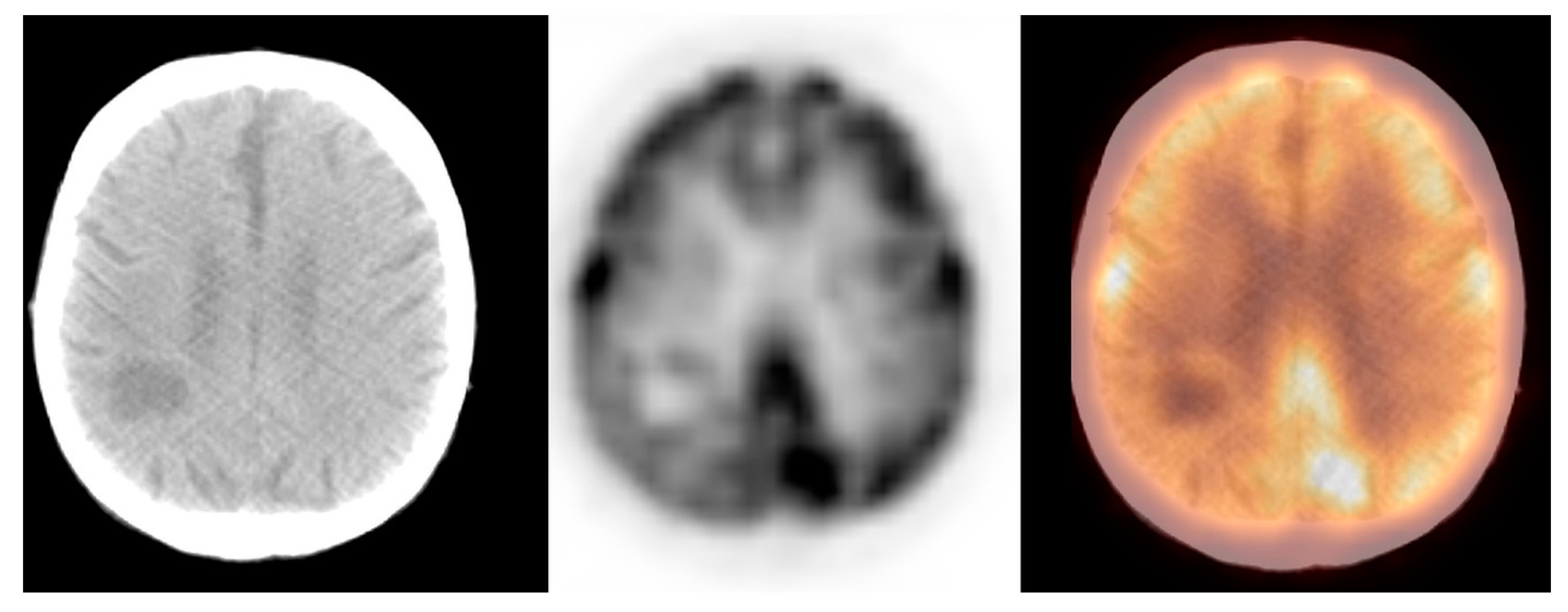 Pharmaceuticals 14 00722 g004 Pharmaceuticals 14 00722 g004