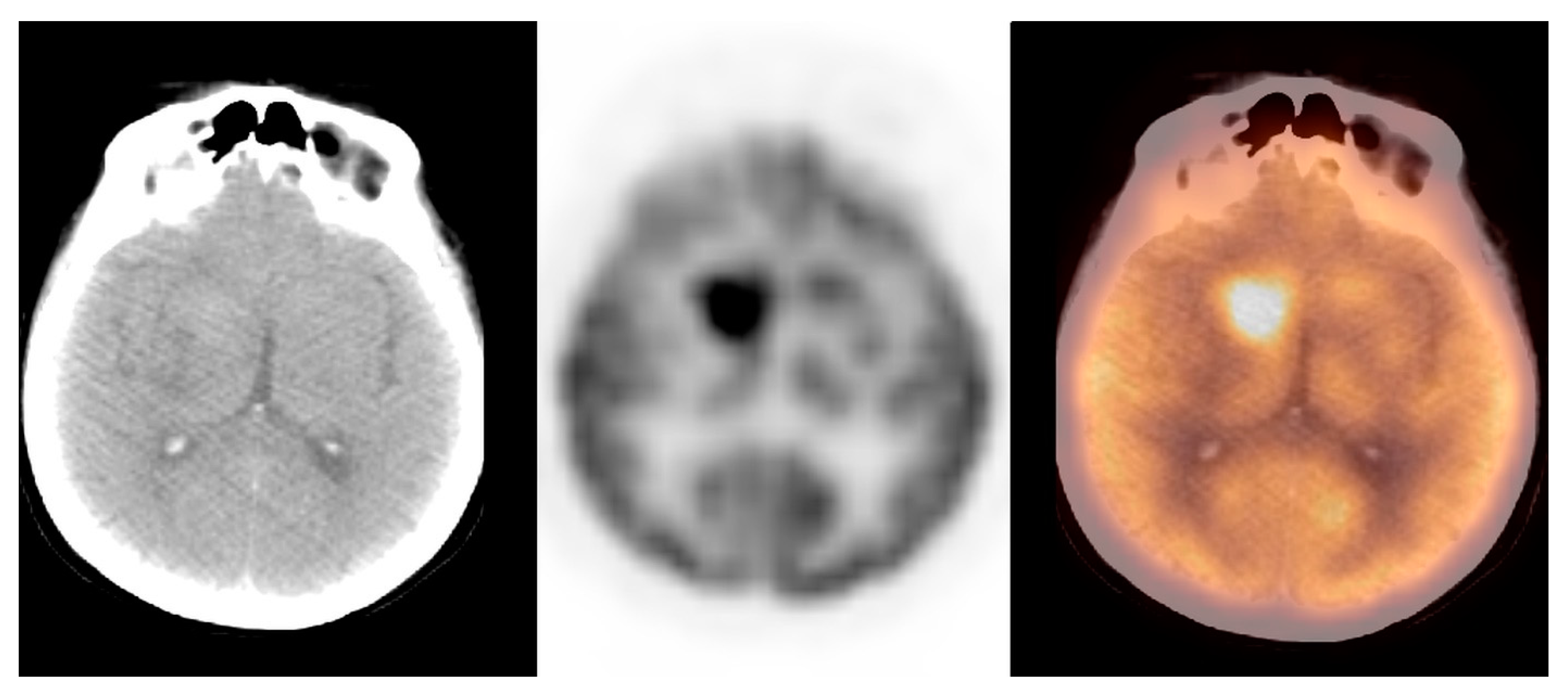 Pharmaceuticals 14 00722 g005 Pharmaceuticals 14 00722 g005