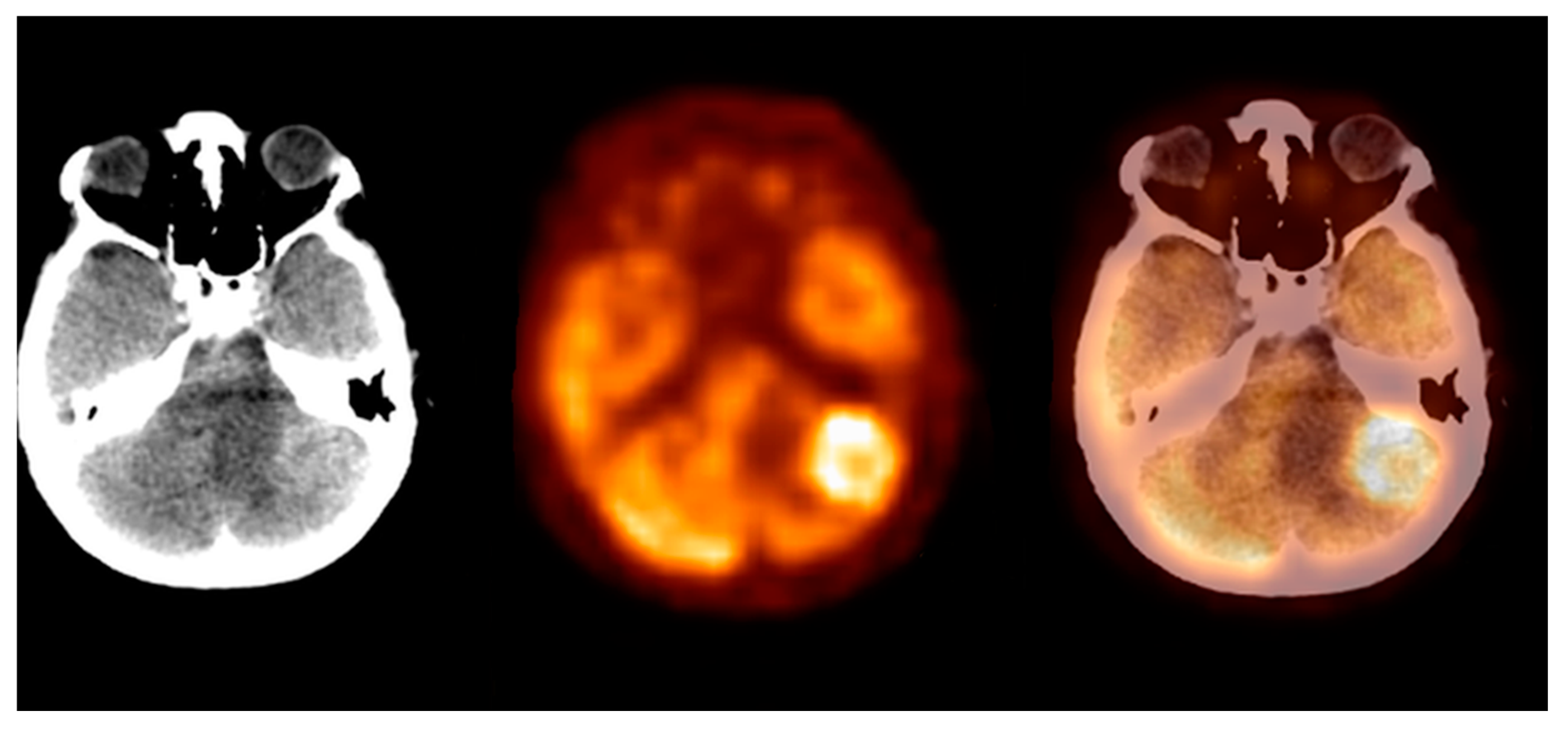 Pharmaceuticals 14 00722 g006 Pharmaceuticals 14 00722 g006