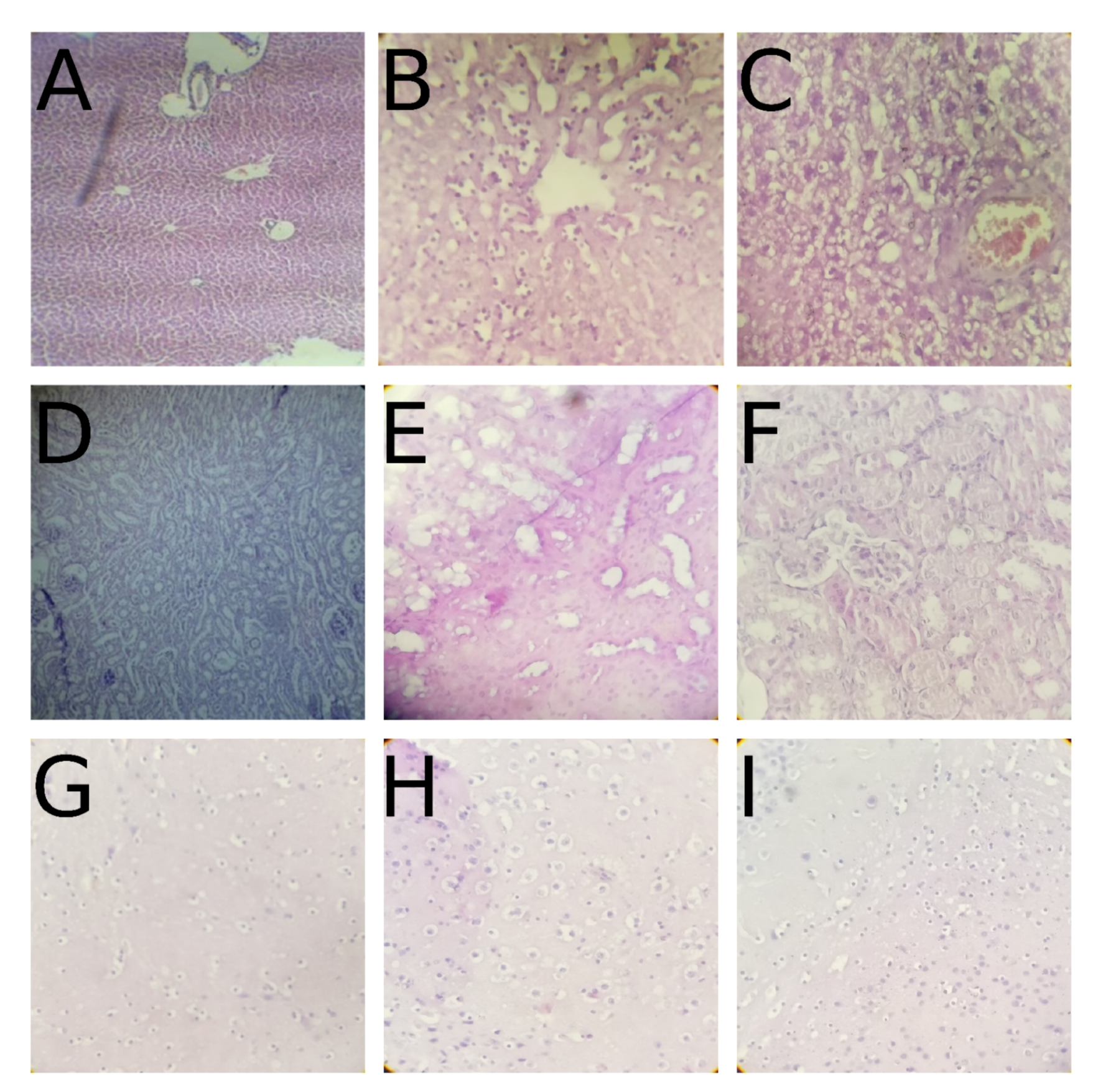Pharmaceuticals 14 00814 g006