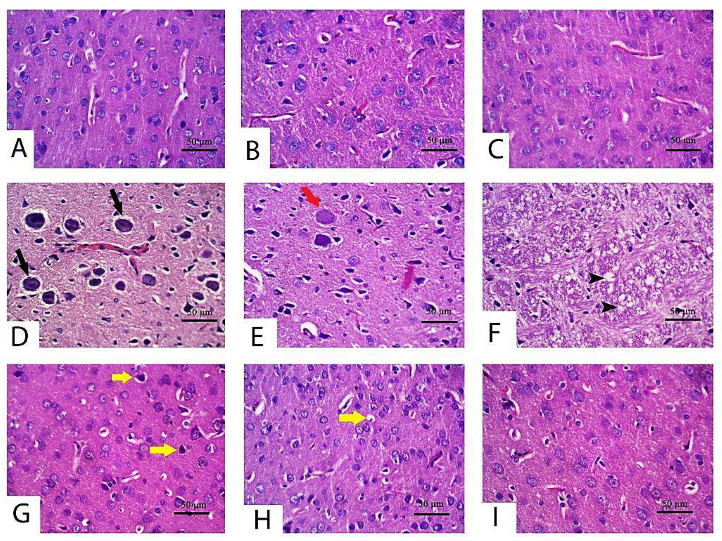 Pharmaceuticals 14 00940 g003