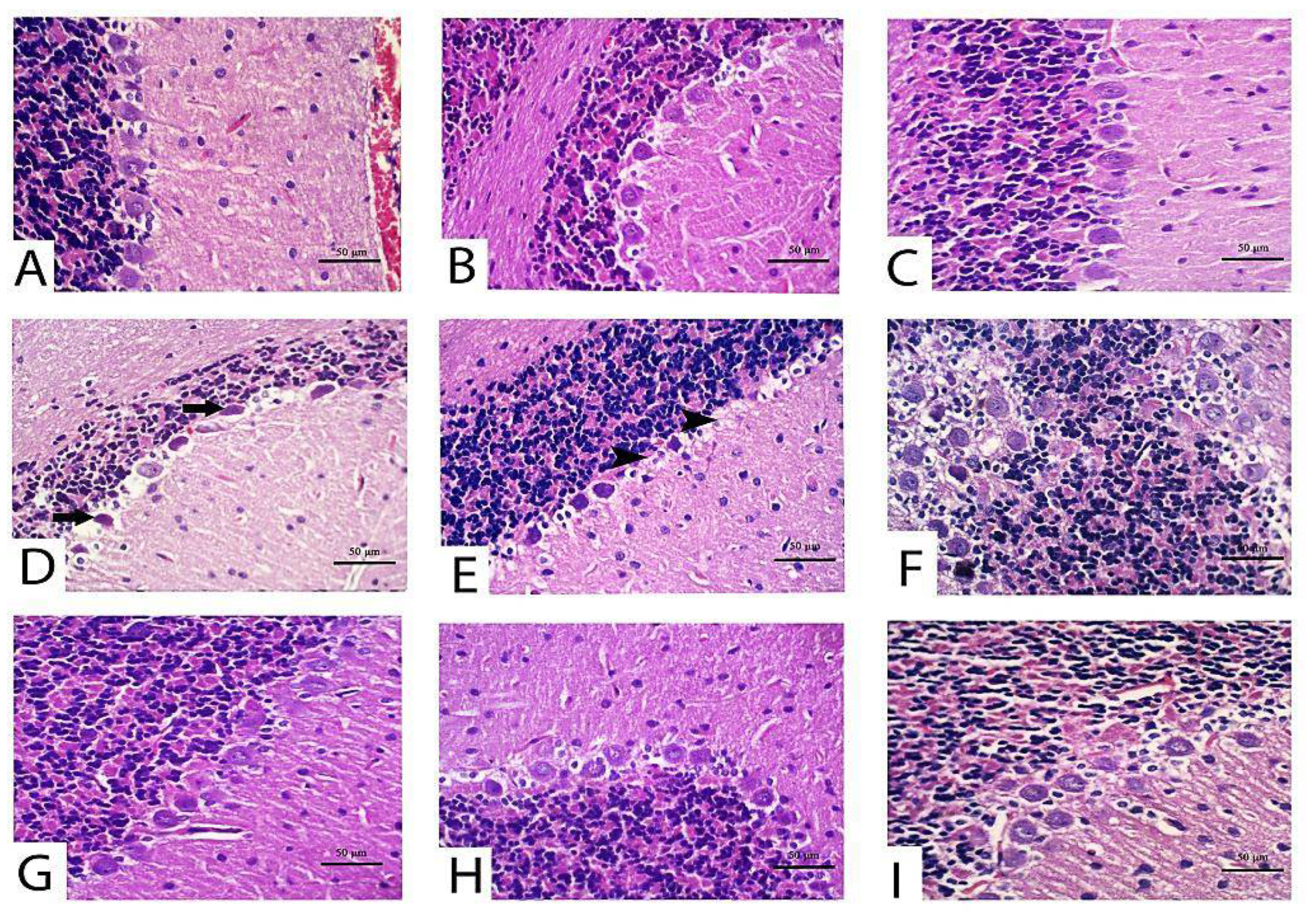 Pharmaceuticals 14 00940 g004
