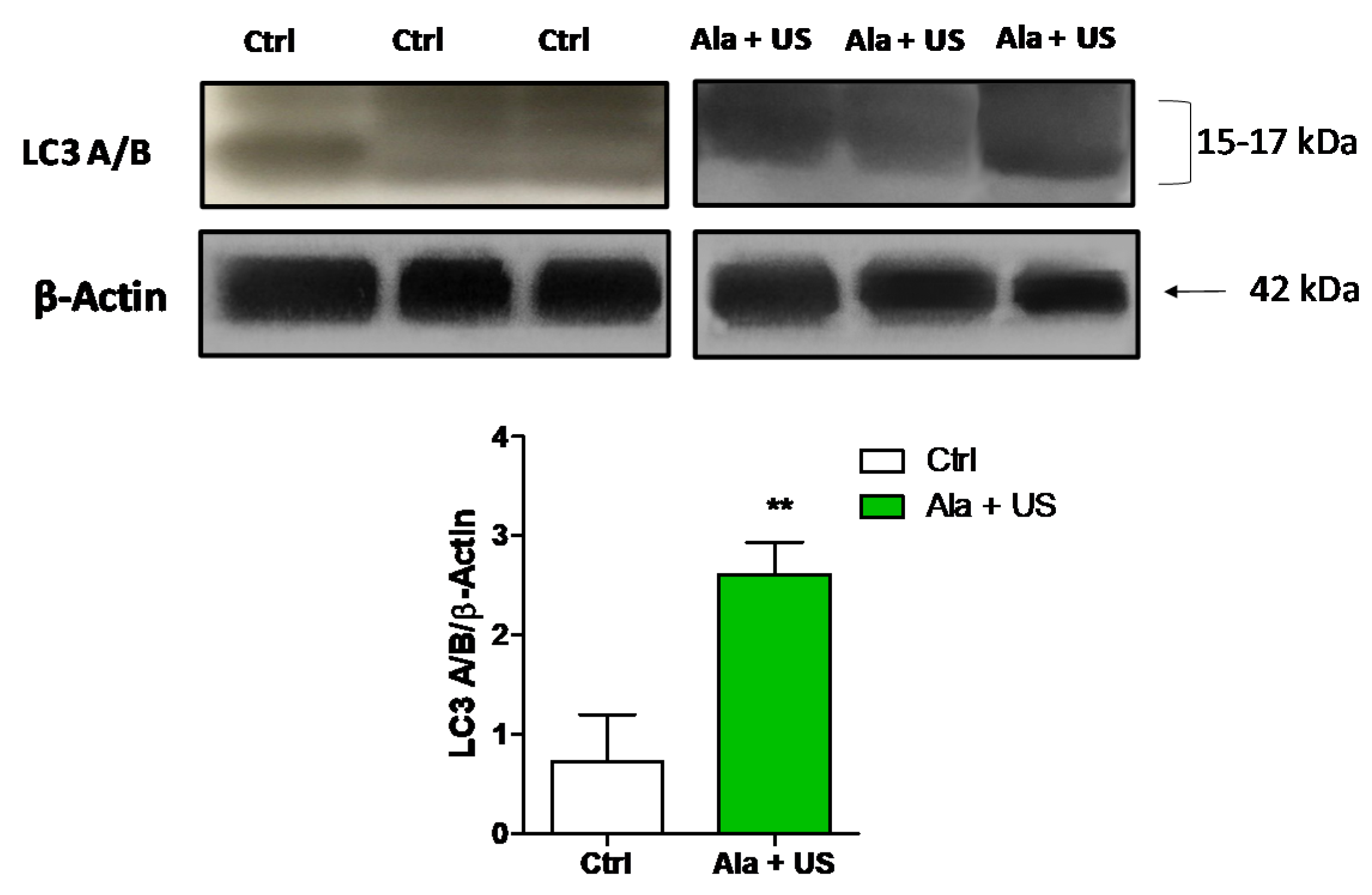 Pharmaceuticals 14 00972 g006