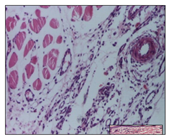 Pharmaceuticals 14 01146 i013 Pharmaceuticals 14 01146 i013