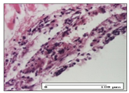 Pharmaceuticals 14 01146 i014 Pharmaceuticals 14 01146 i014