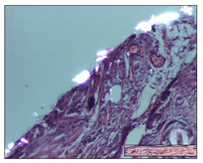 Pharmaceuticals 14 01146 i028 Pharmaceuticals 14 01146 i028