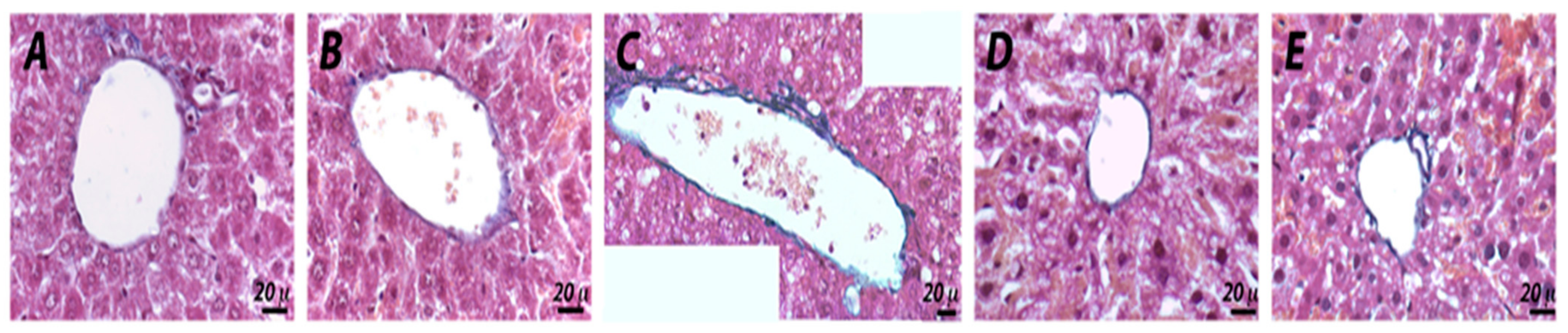 Pharmaceuticals 14 01149 g009