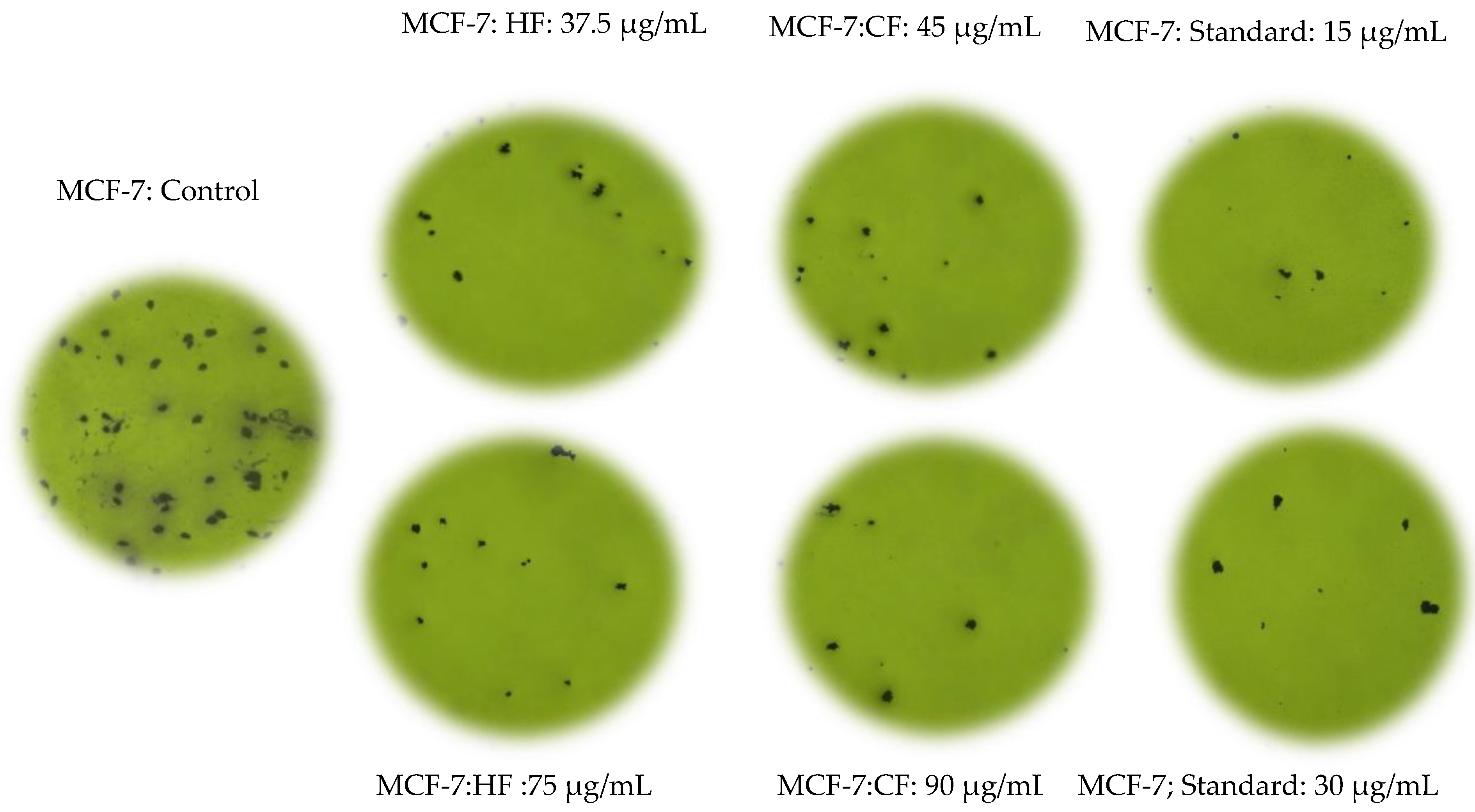 Pharmaceuticals 14 01154 g003 550