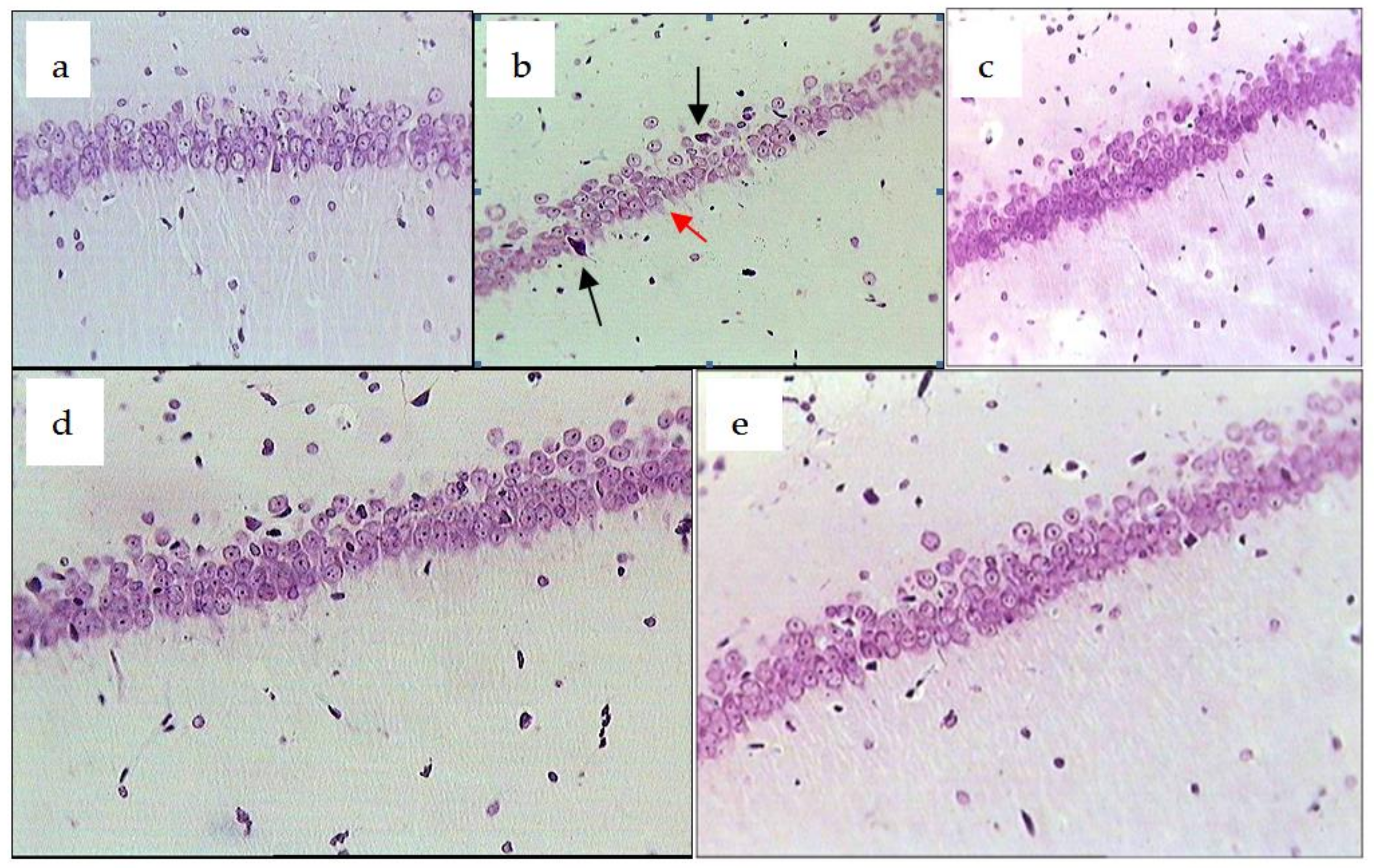 Pharmaceuticals 14 01186 g005