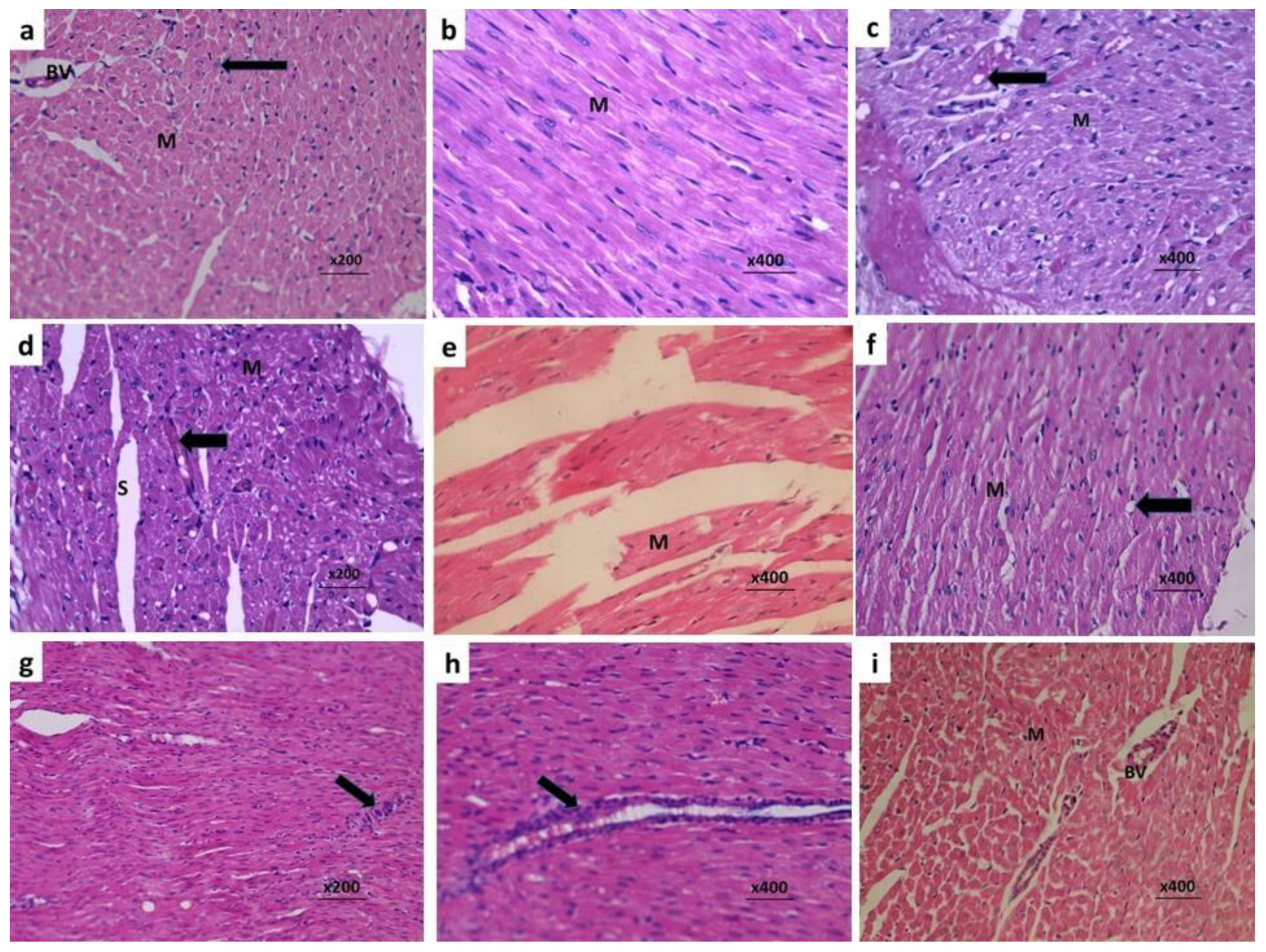 Pharmaceuticals 14 01188 g005