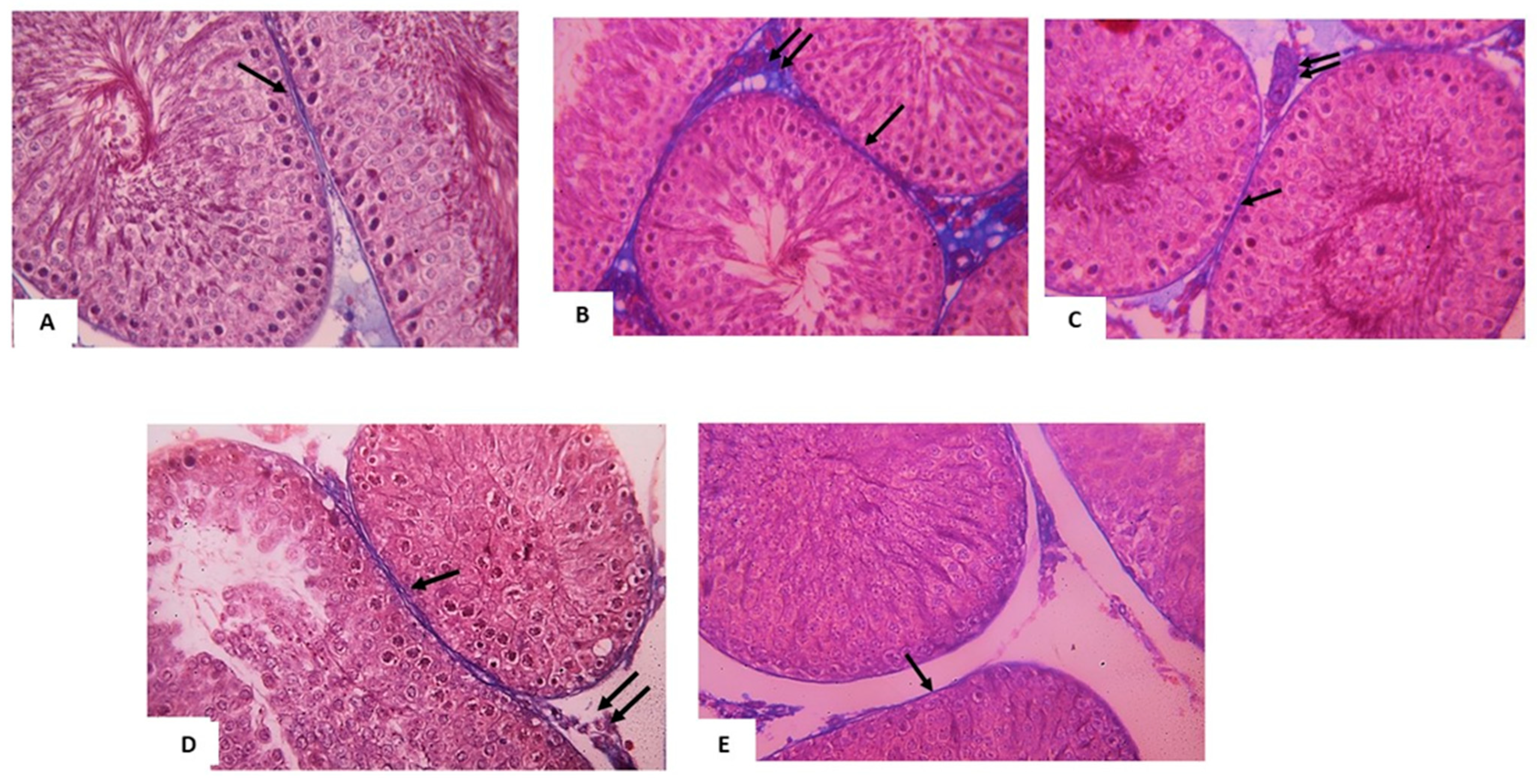 Pharmaceuticals 14 01222 g002 Pharmaceuticals 14 01222 g002