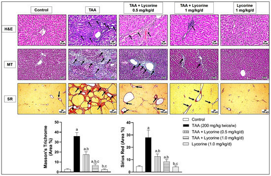 Lycorine Ameliorates Thioacetamide-Induced Hepatic Fibrosis