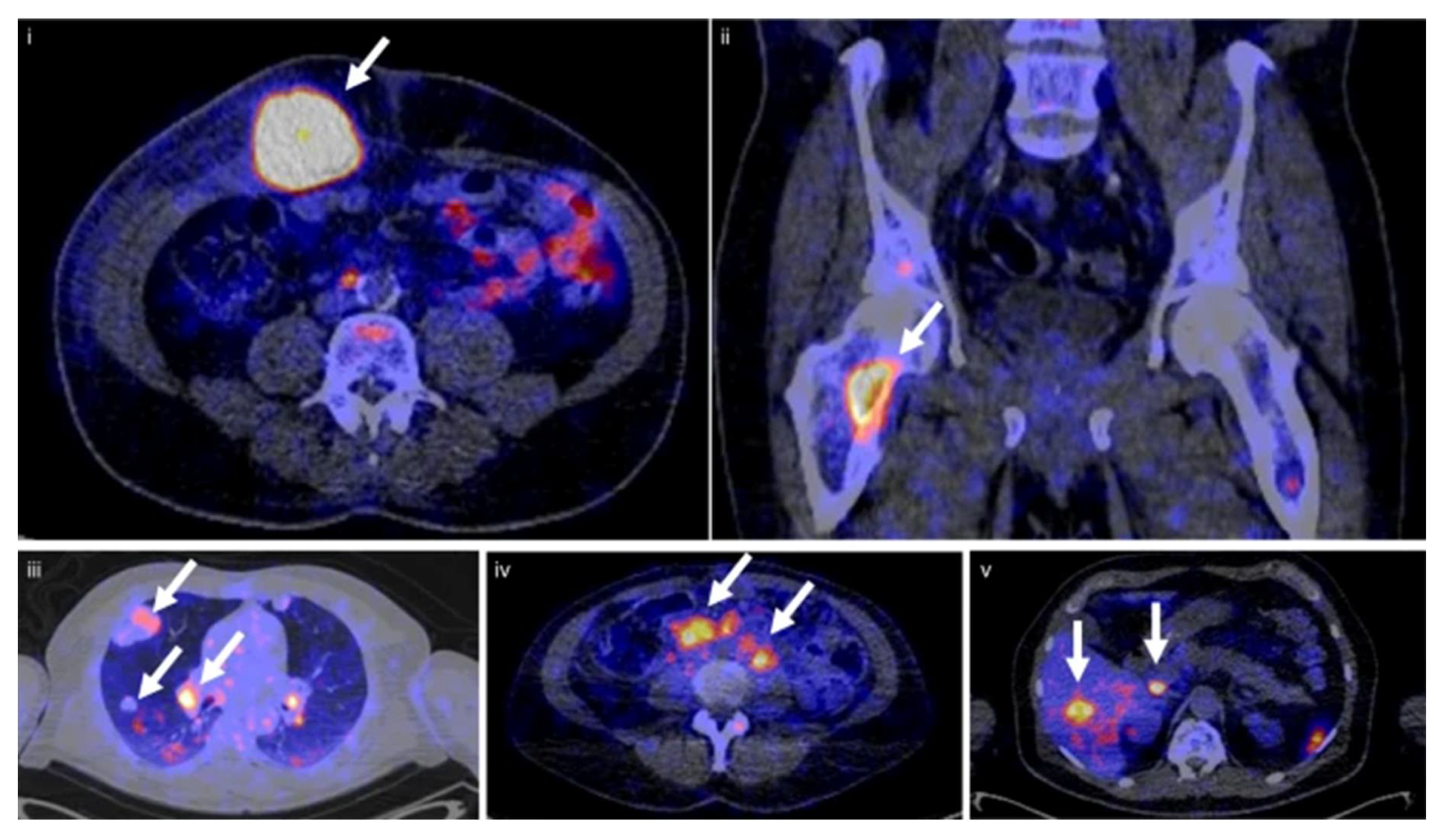 Pharmaceuticals 15 00747 g004 Pharmaceuticals 15 00747 g004