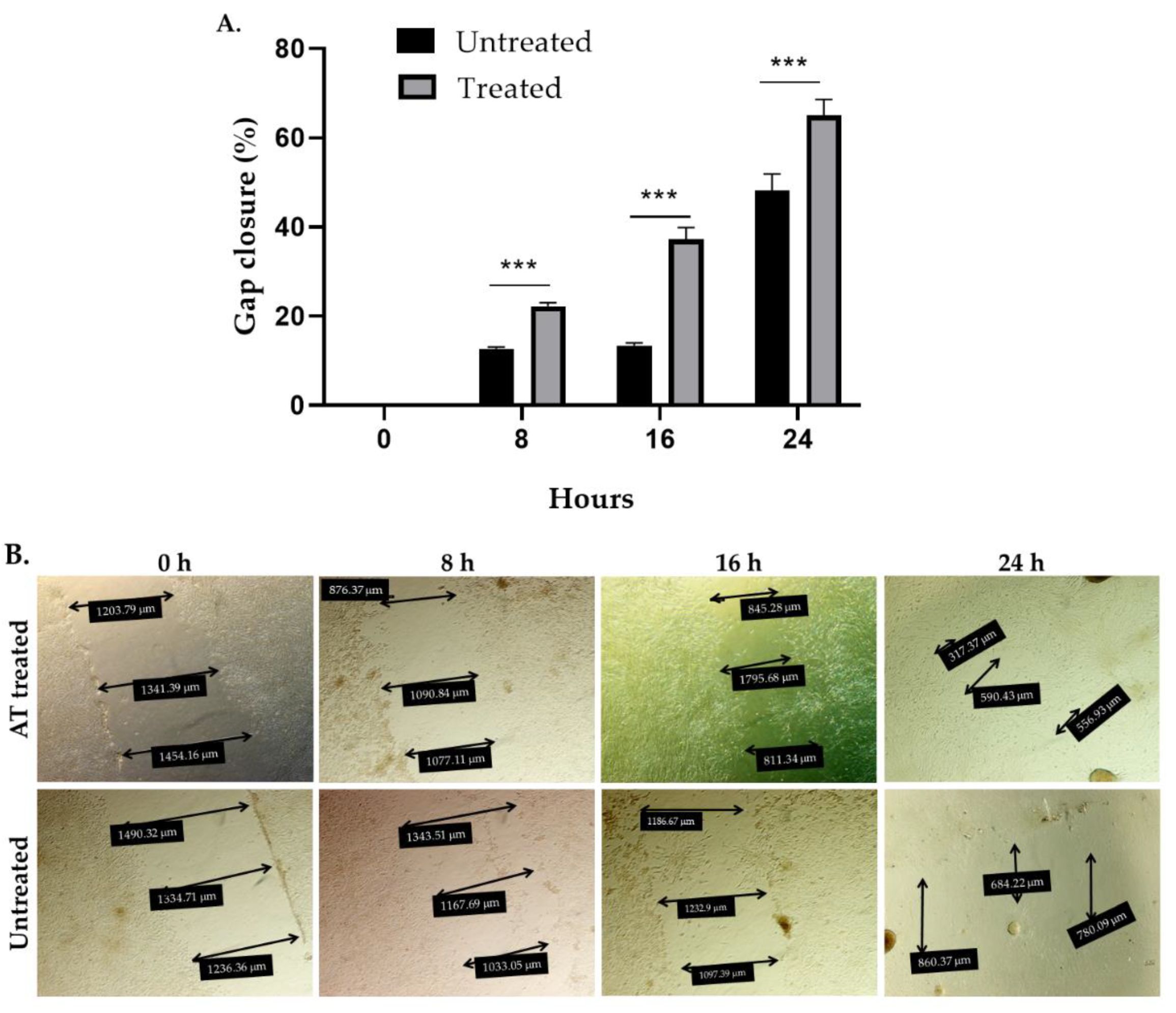 Pharmaceuticals 15 00776 g005 550