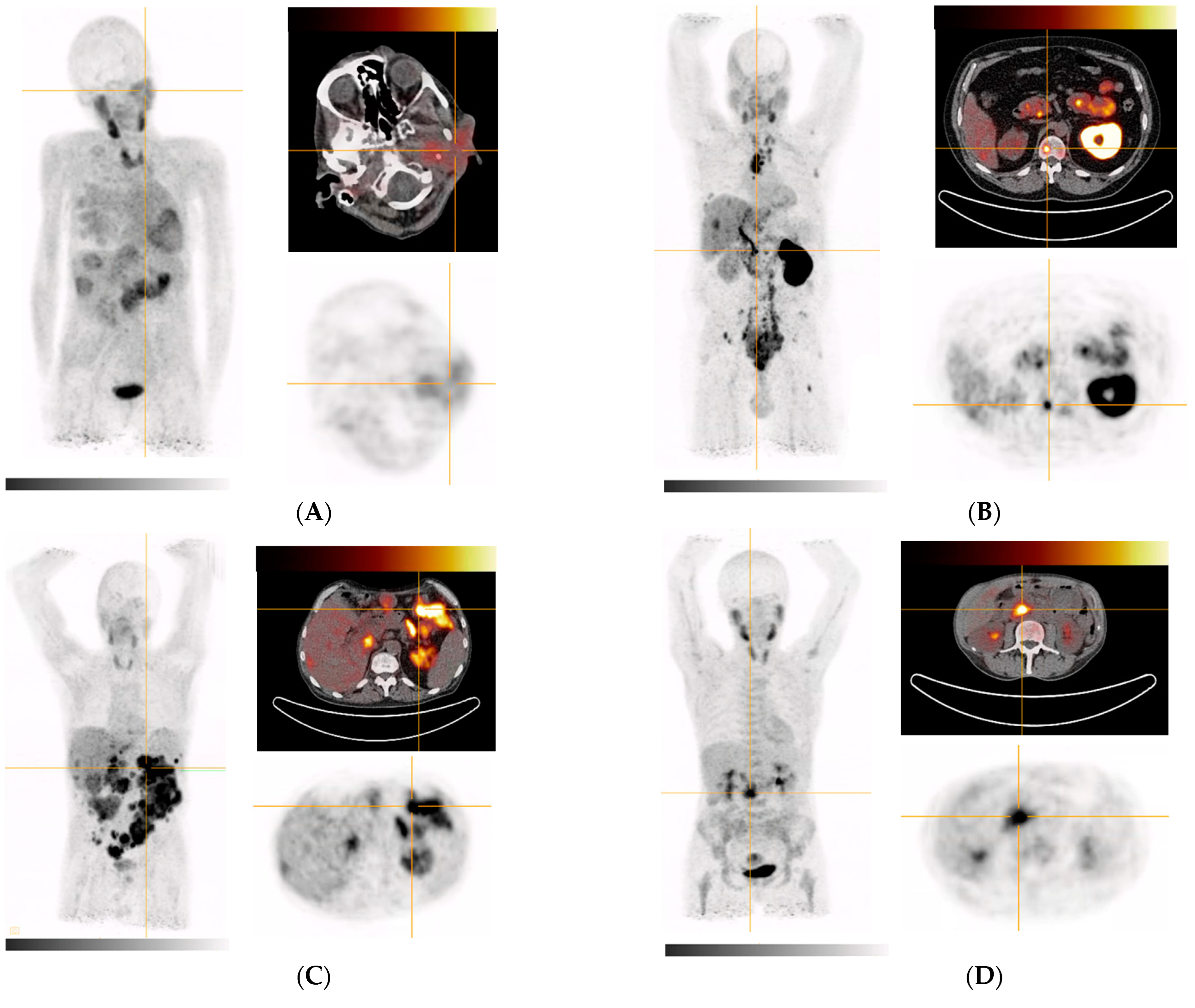 Pharmaceuticals 15 01000 g004