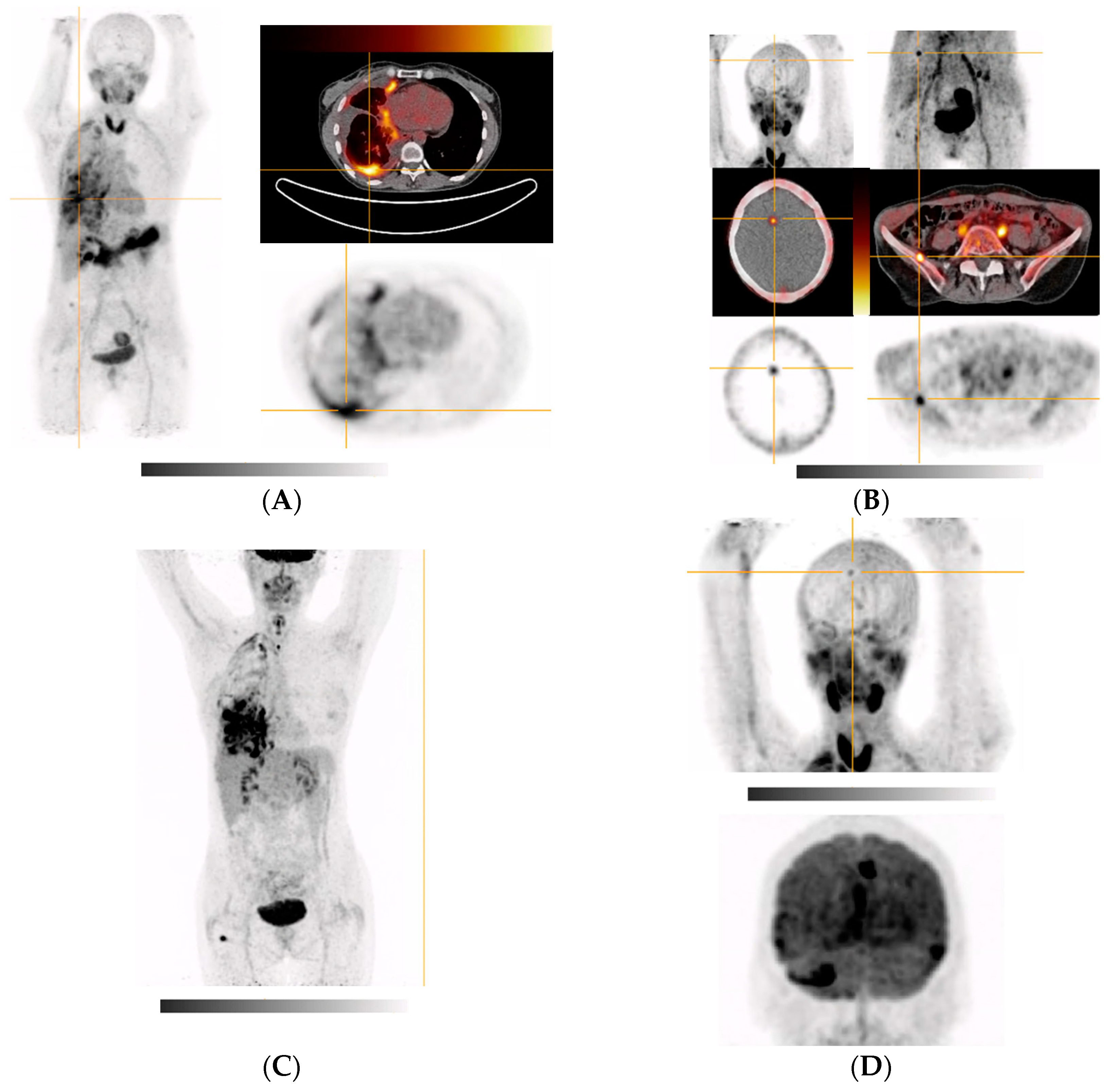 Pharmaceuticals 15 01000 g005
