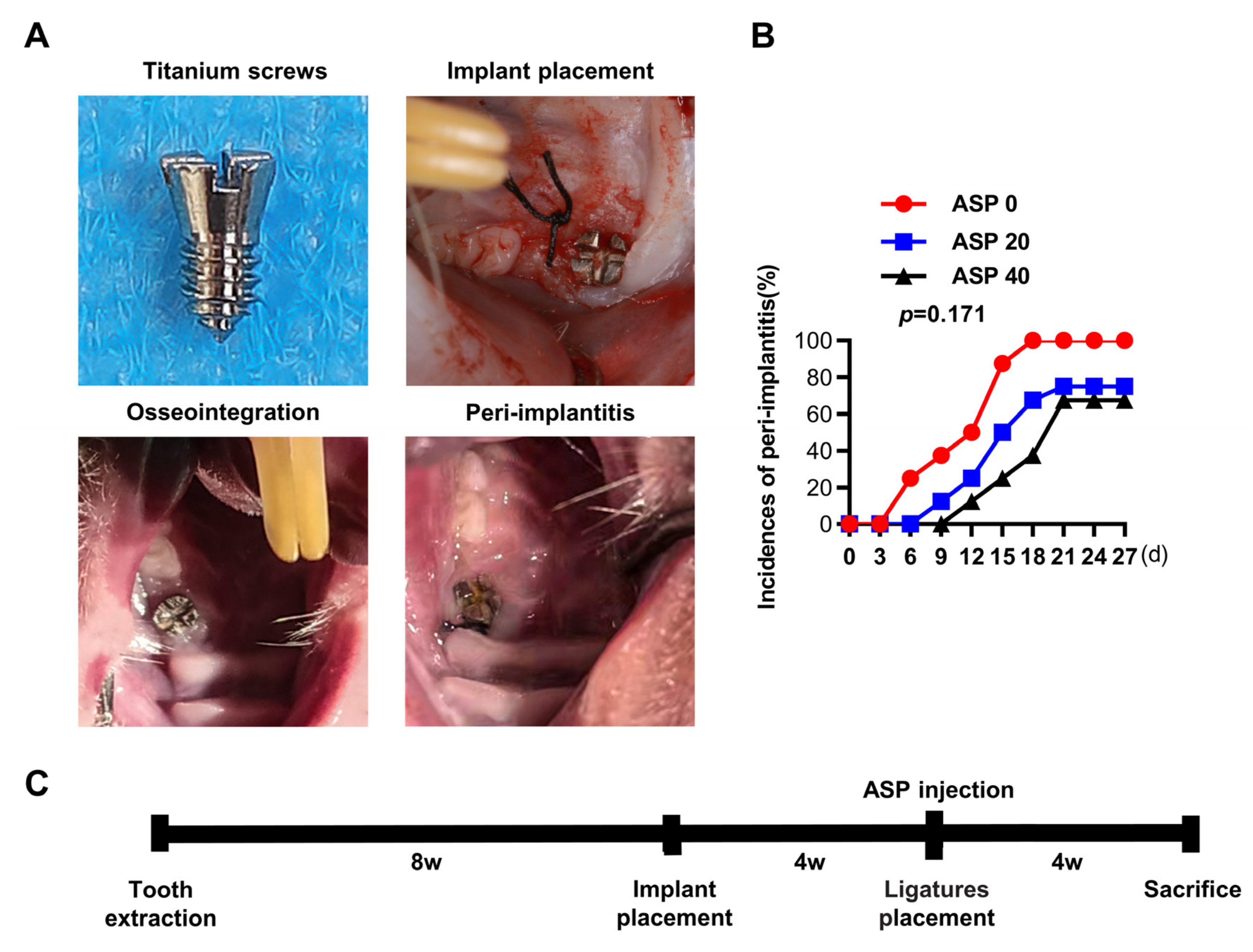 Asperuloside Prevents Peri-Implantitis via Suppression of NF