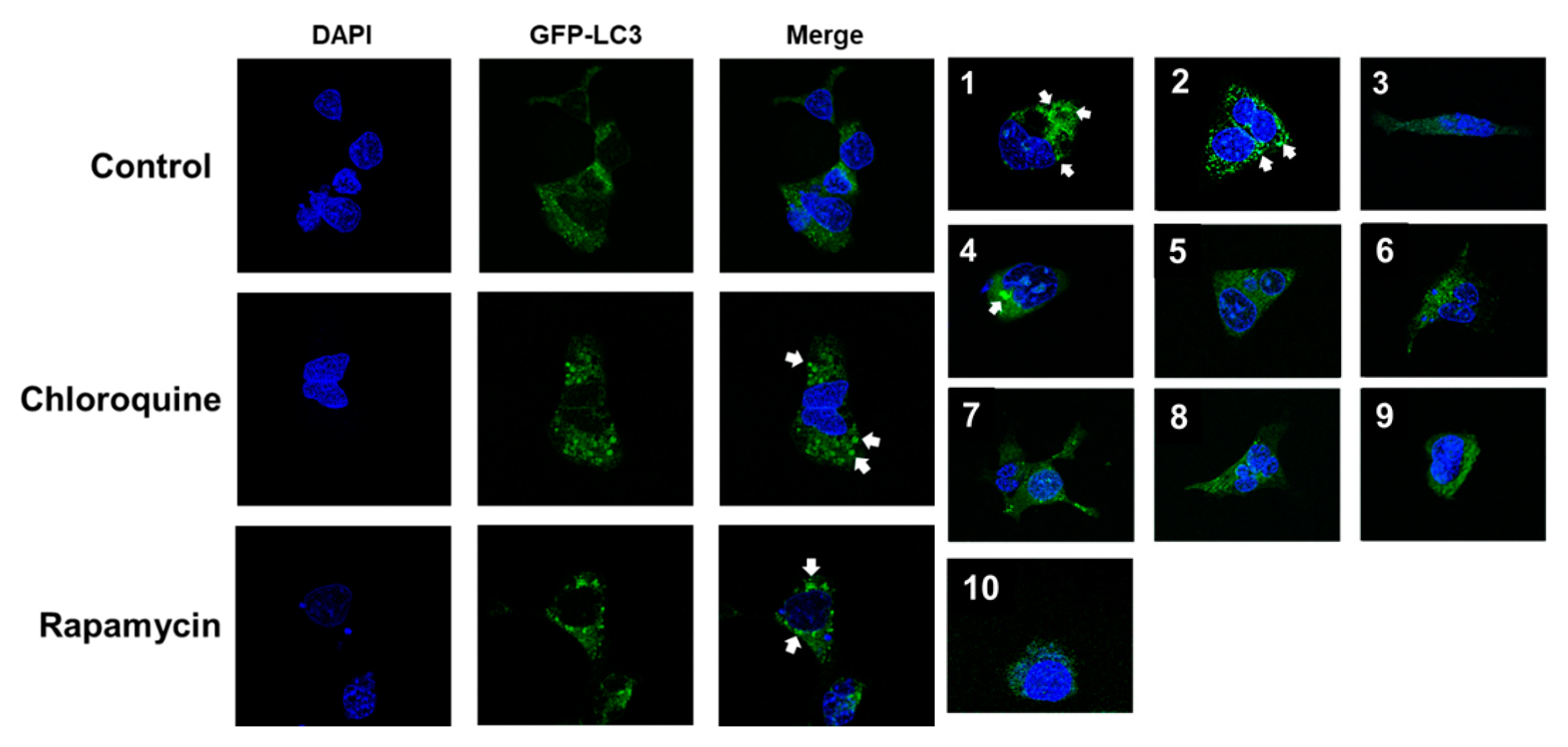 Pharmaceuticals 15 01332 g004