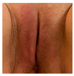 Pharmaceuticals 15 01571 i004 Pharmaceuticals 15 01571 i004