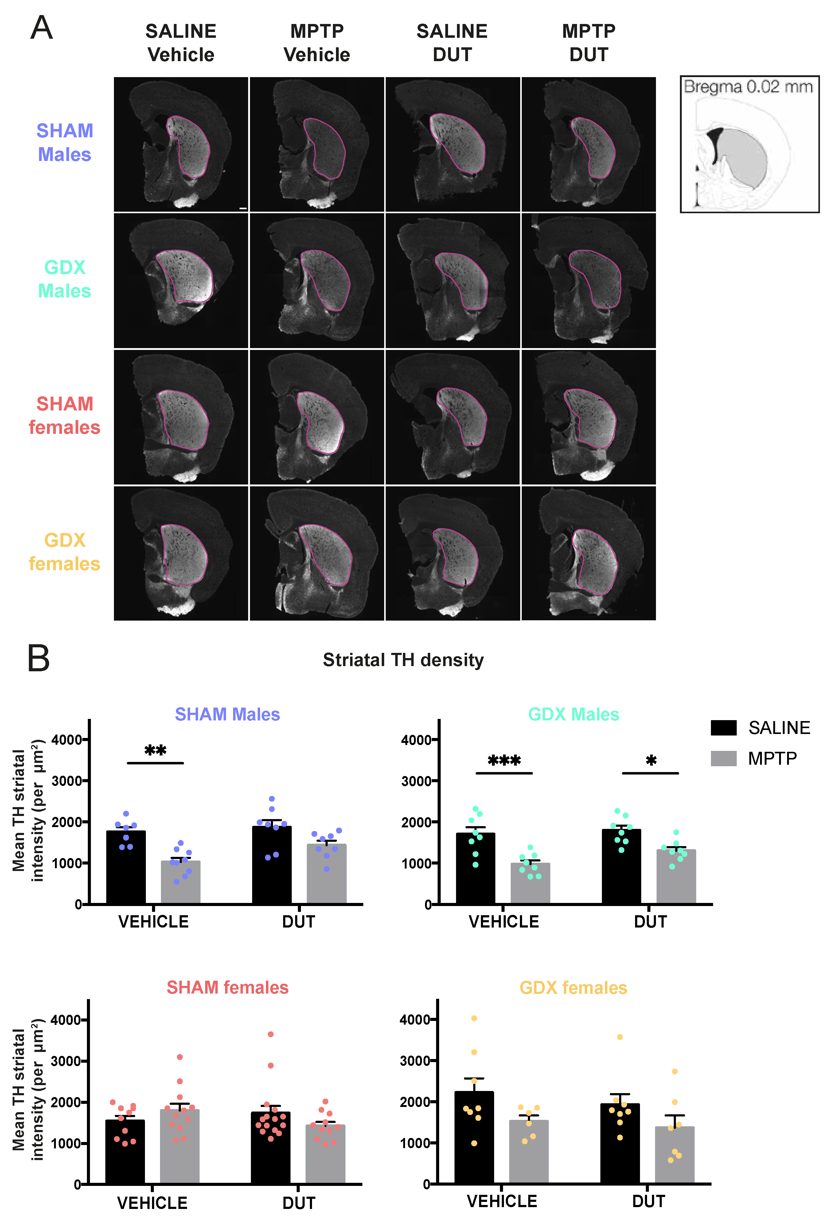 Pharmaceuticals Free Full-Text Three-Dimensional Analysis of Sex- and Gonadal Status- Dependent Microglial Activation in a Mouse Model of Parkinsonandrsquo;s Disease