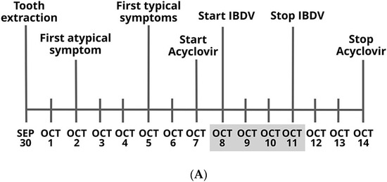 average cost of acyclovir