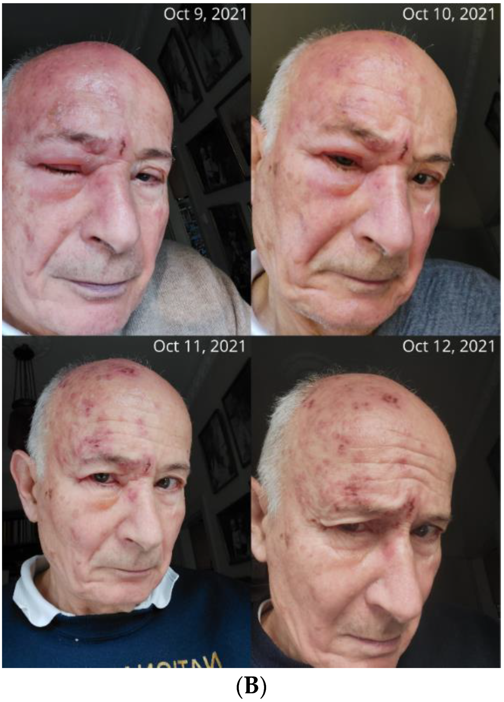 Pharmaceuticals 16 00226 g001b 550