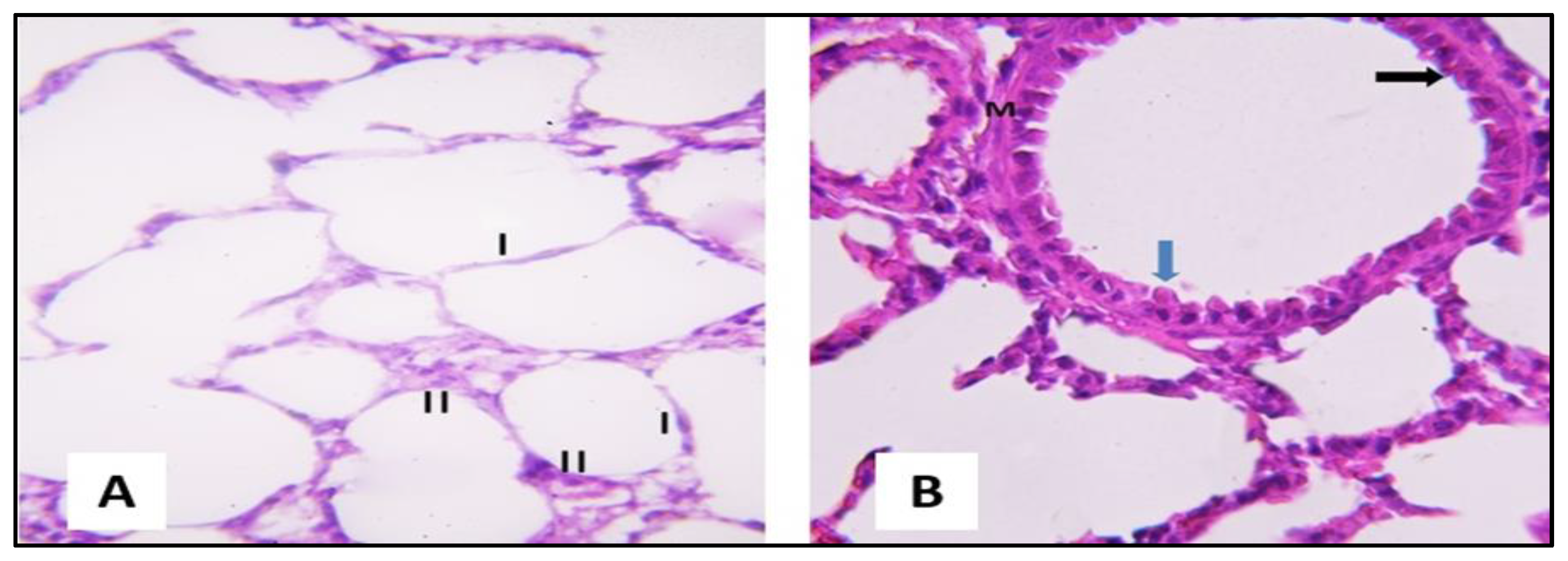 Pharmaceuticals 16 00318 g004 Pharmaceuticals 16 00318 g004