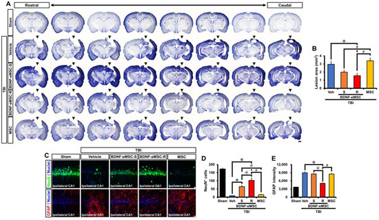 Engineered Mesenchymal Stem Cells Over-Expressing BDNF Protect the ...