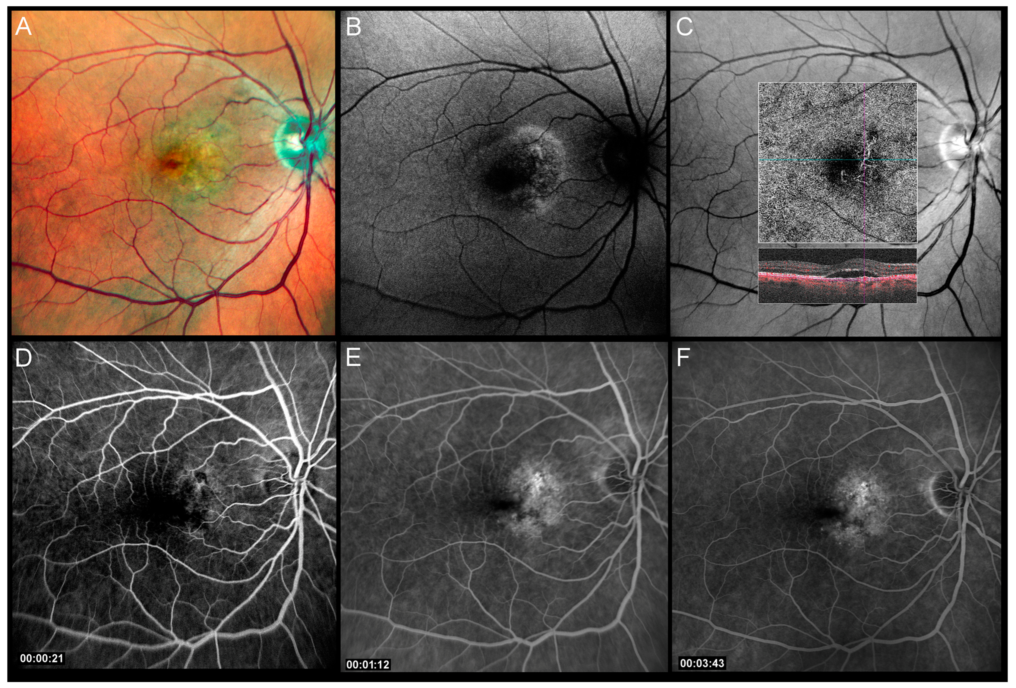 Pharmaceuticals 16 00494 g001