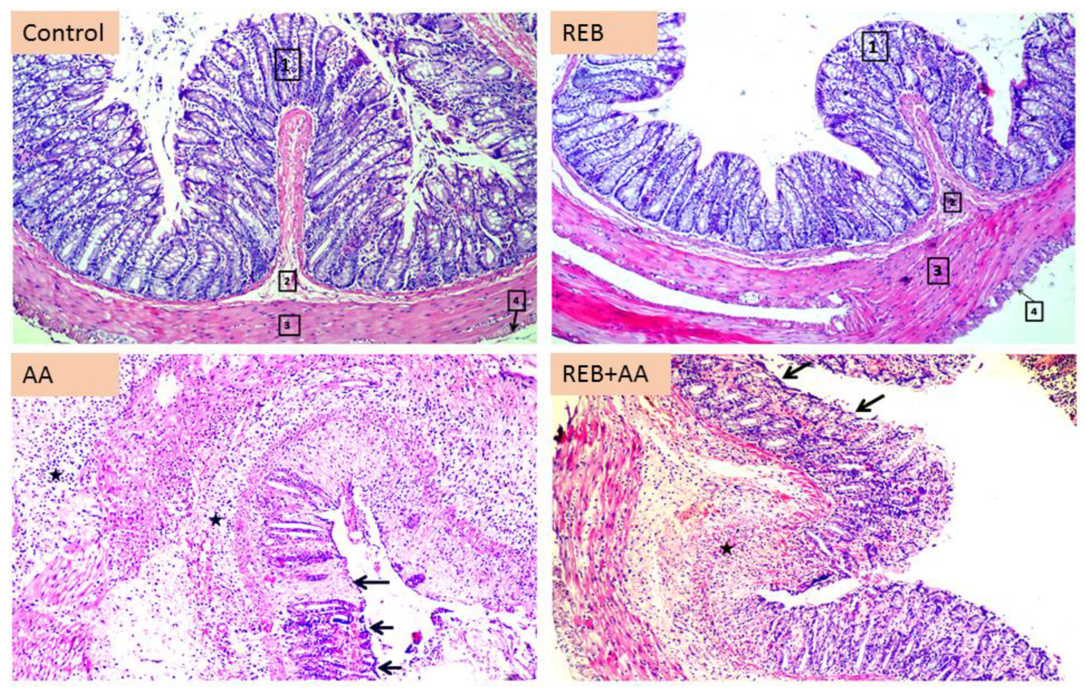 Pharmaceuticals 16 00533 g002