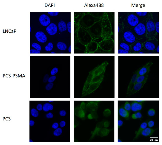 PC3-PSMA Cell Line: A High-Utility Model for PSMA-Directed Prostate Cancer Research