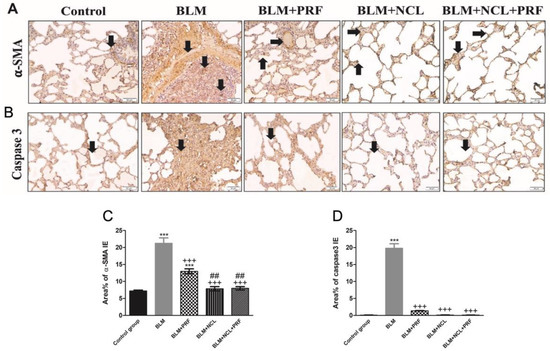 Combination of Niclosamide and Pirfenidone Alleviates Pulmonary ...