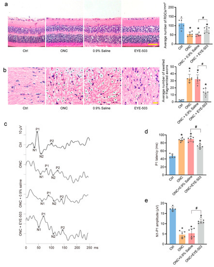 EYE-503: A Novel Retinoic Acid Drug for Treating Retinal