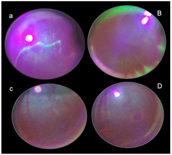 bpc 157 eye sight 5 Ways the Peptide BPC 157 Can Help Repair, Restore and Rejuvenate