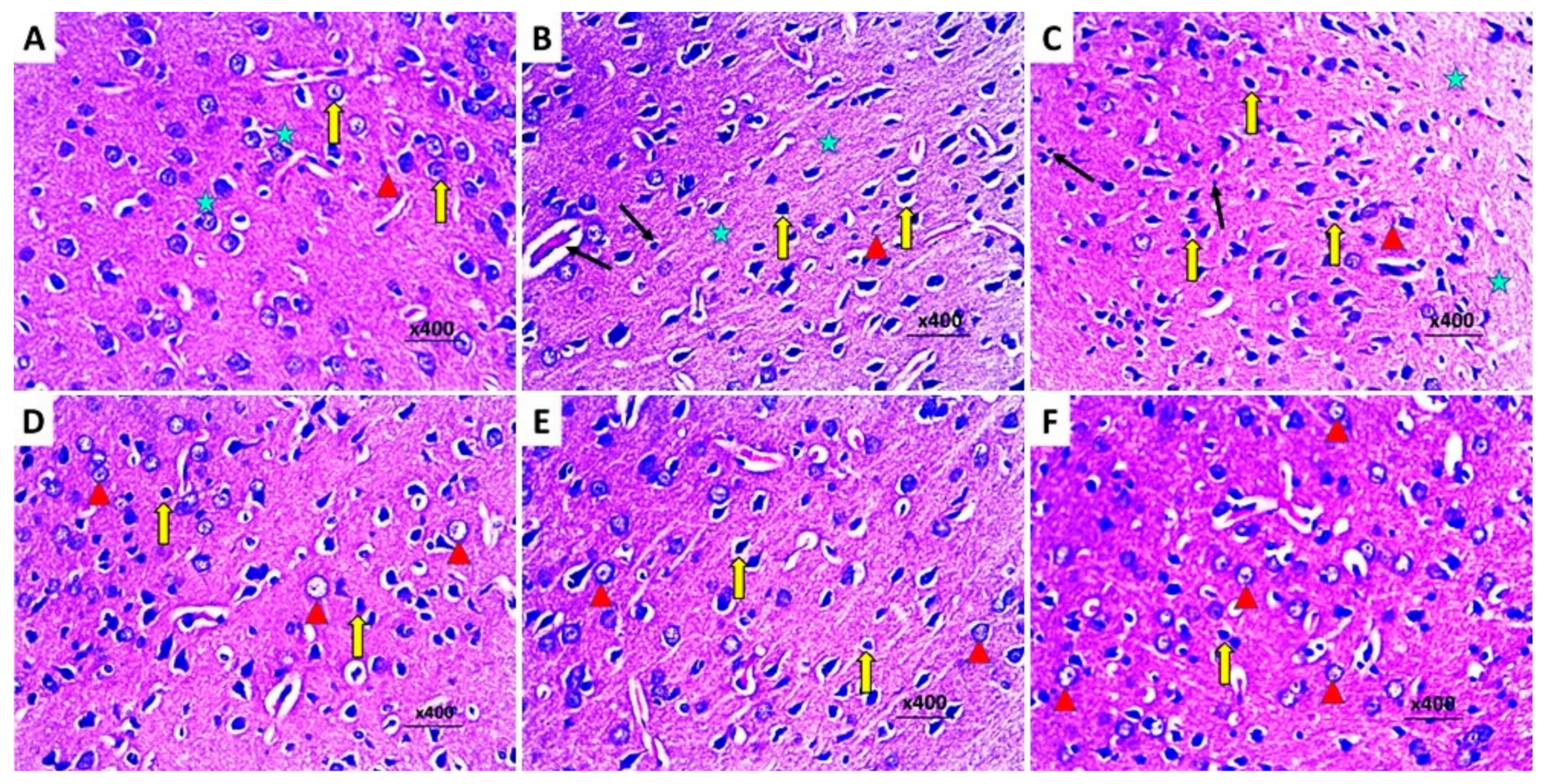 Pharmaceuticals 16 01370 g012