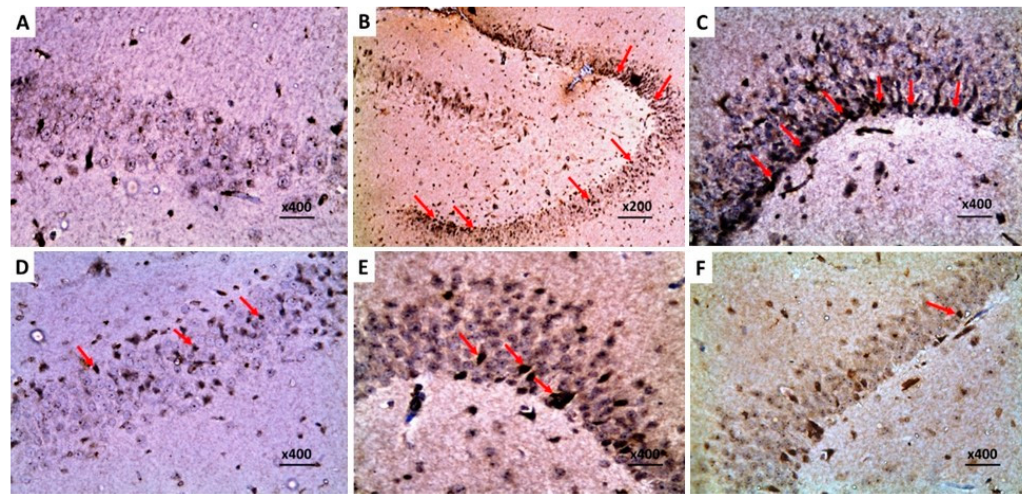 Pharmaceuticals 16 01370 g013