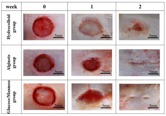 Wound Healing Performance in a Moist Environment of Crystalline Glucose ...