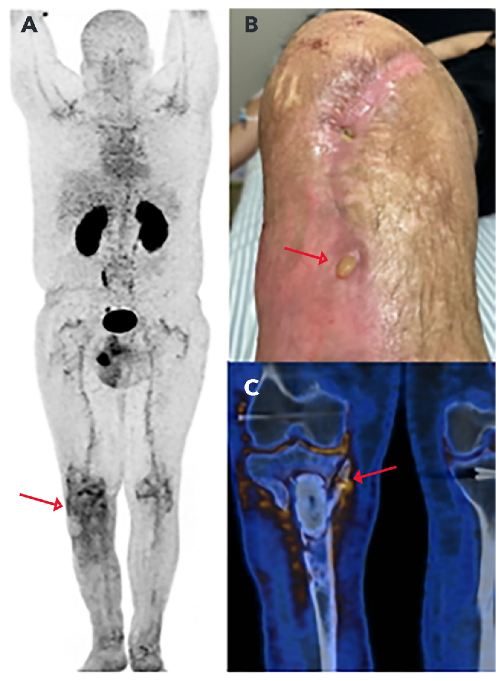 Pharmaceuticals 17 00048 g008 Pharmaceuticals 17 00048 g008