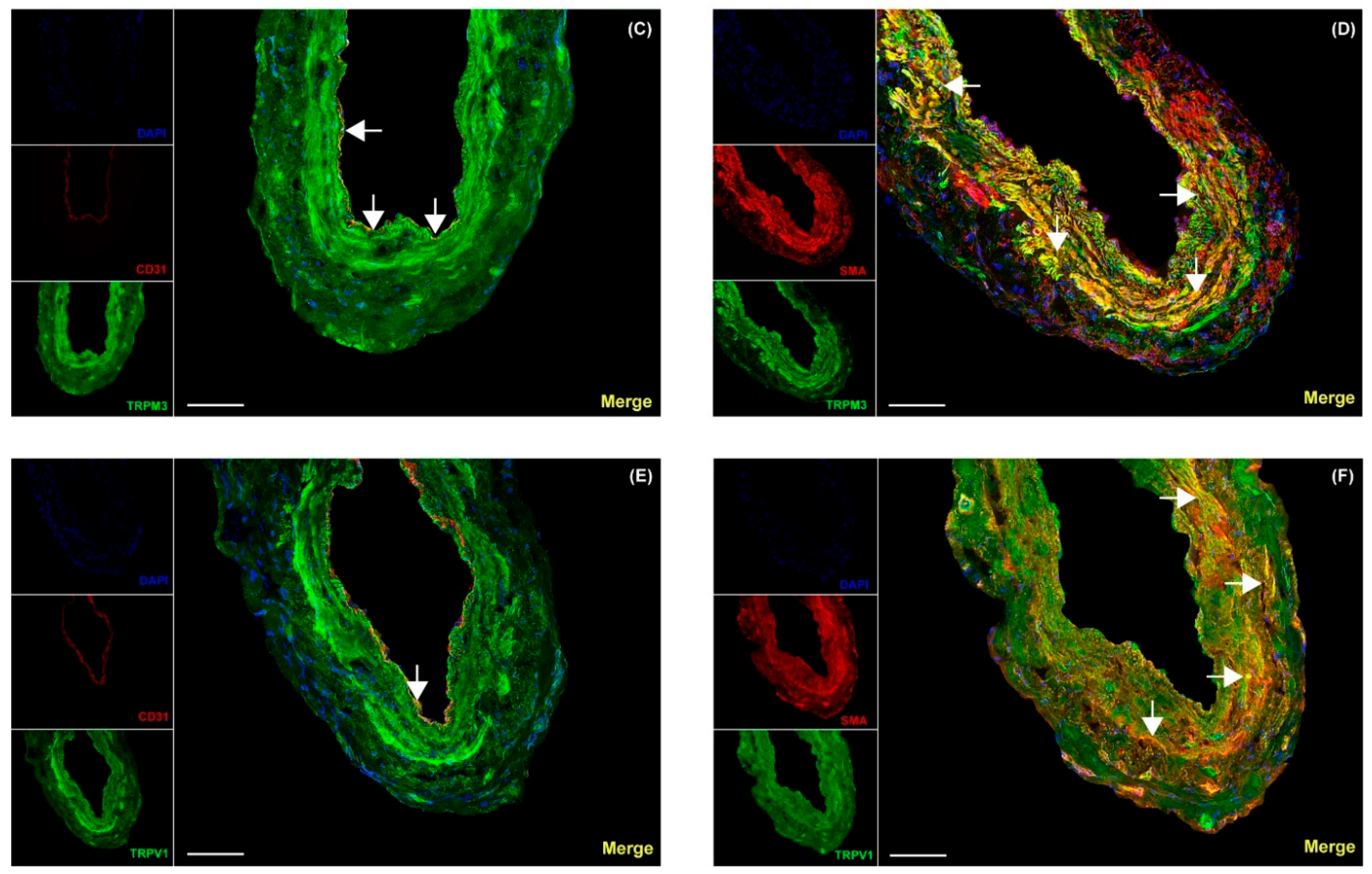 Pharmaceuticals 17 00156 g003b