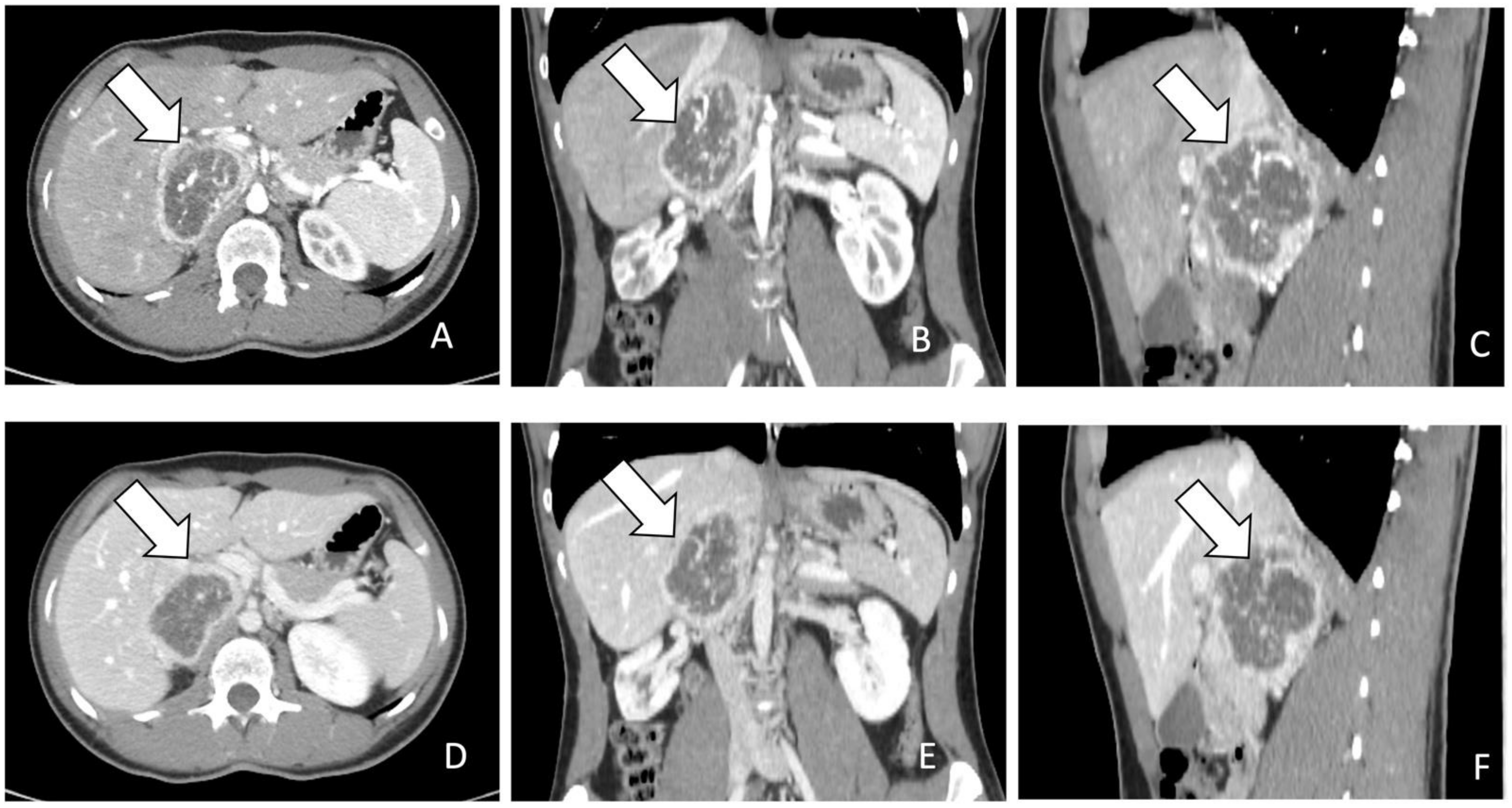 Pharmaceuticals 17 00354 g001 Pharmaceuticals 17 00354 g001