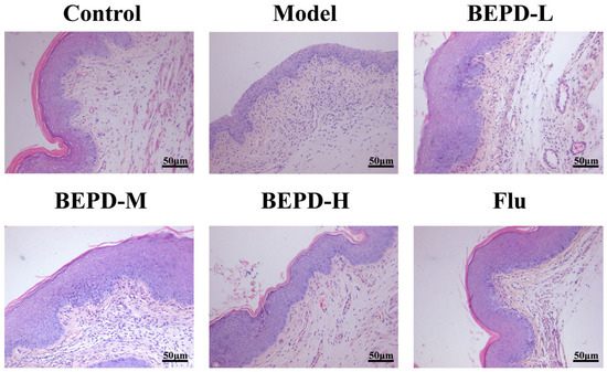 Transcriptomics Reveals Effect of Pulsatilla Decoction