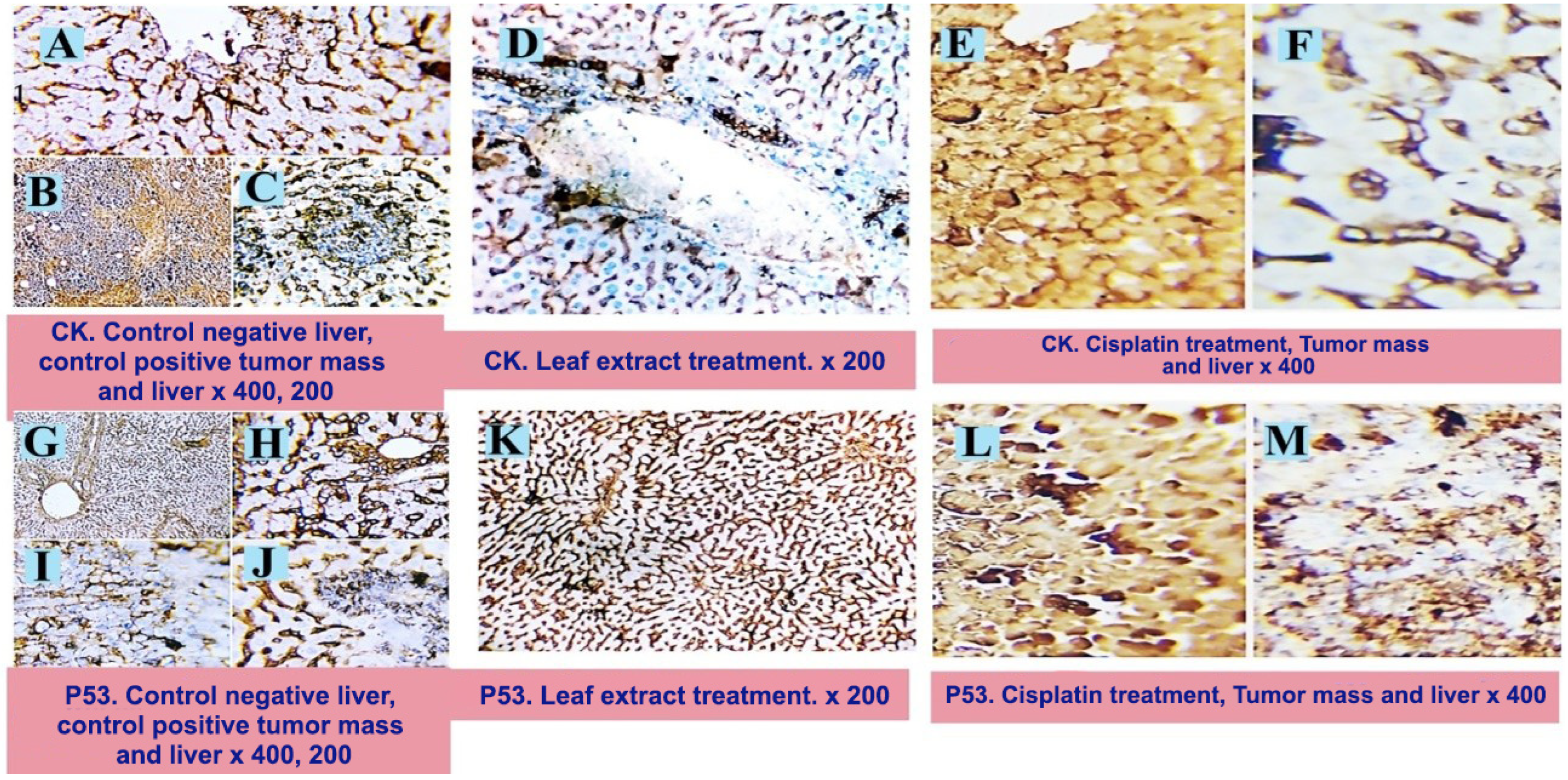 Pharmaceuticals 17 00614 g004